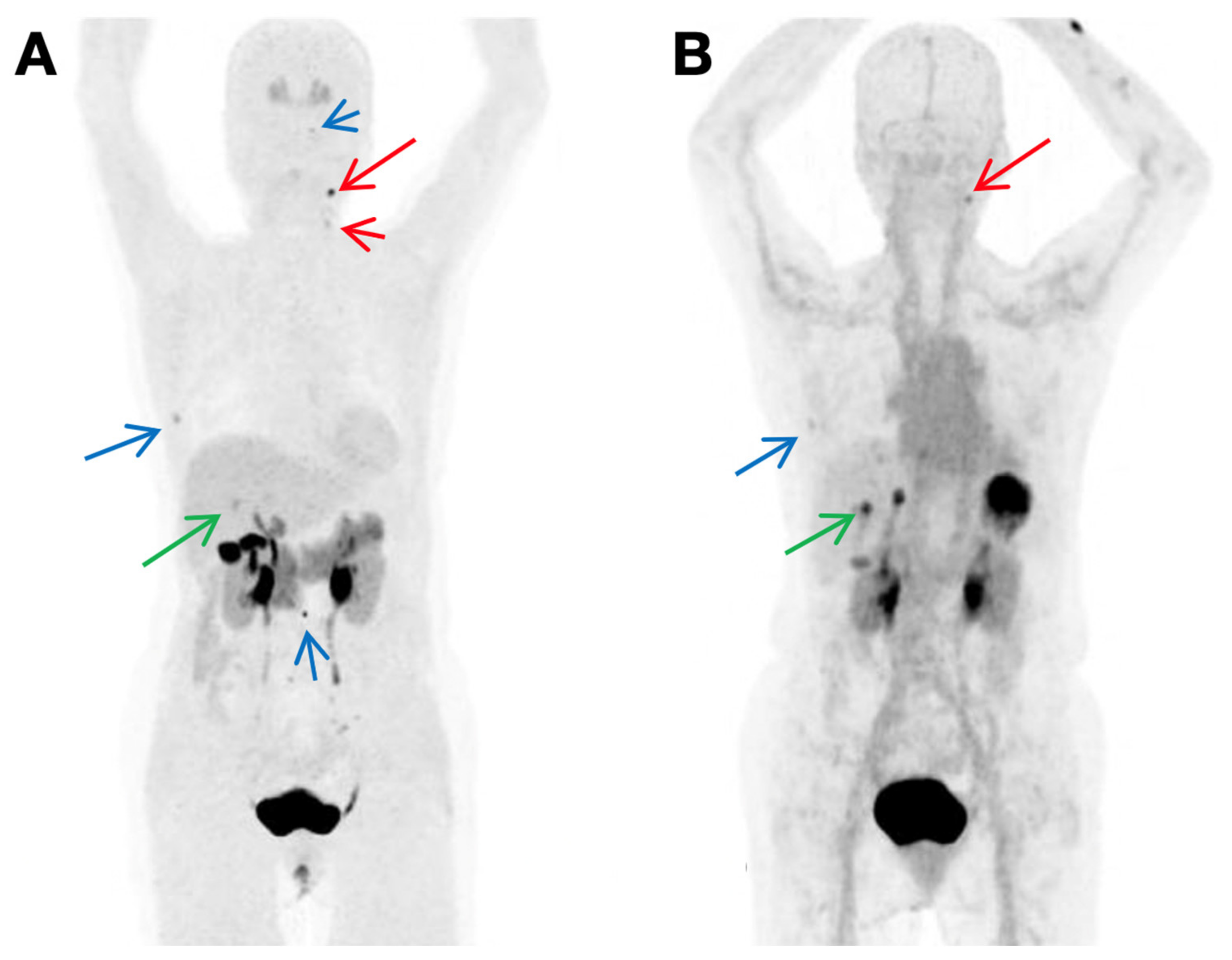 Cancers 13 03188 g007 Cancers 13 03188 g007