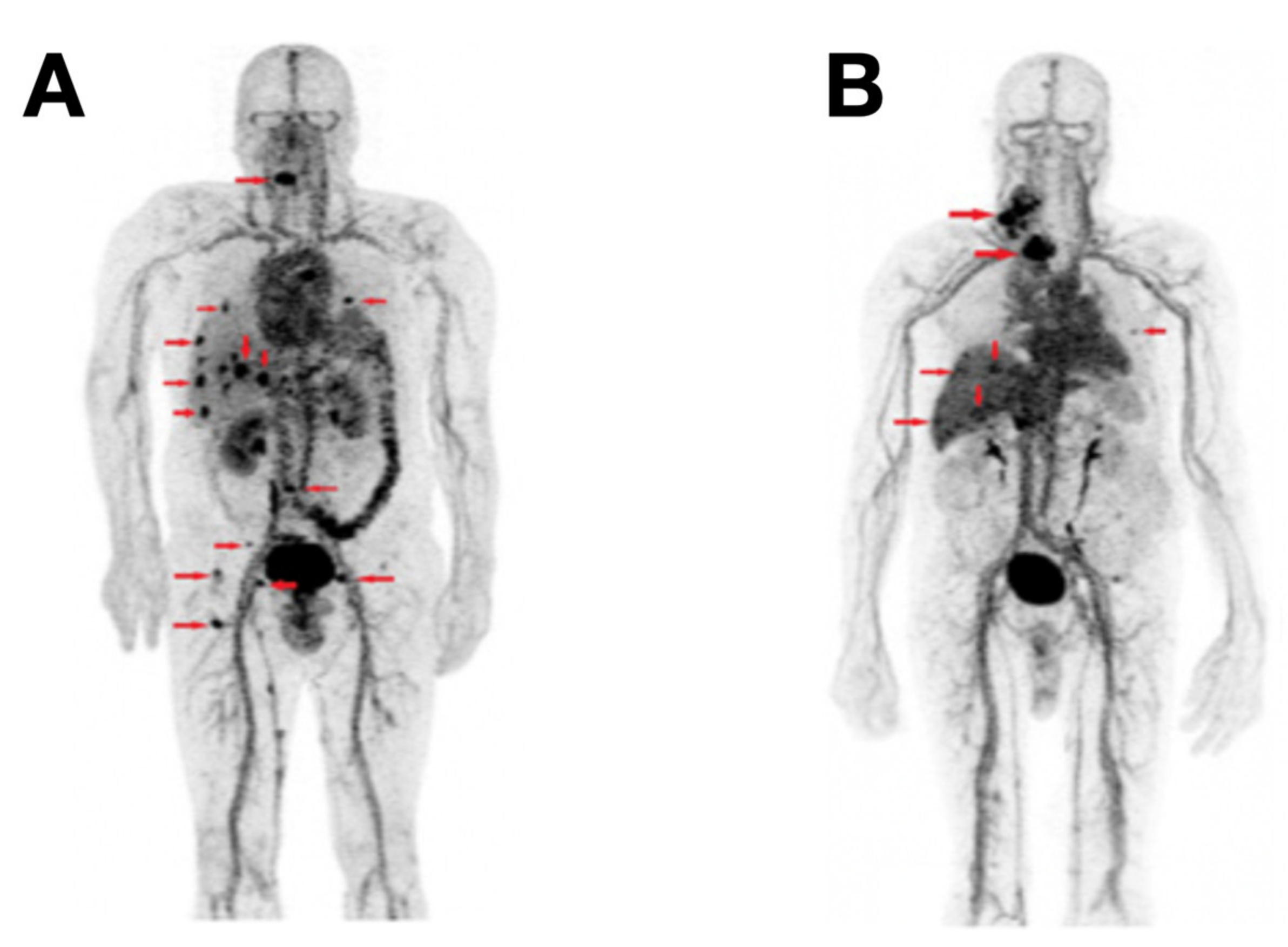 Cancers 13 03188 g011 Cancers 13 03188 g011