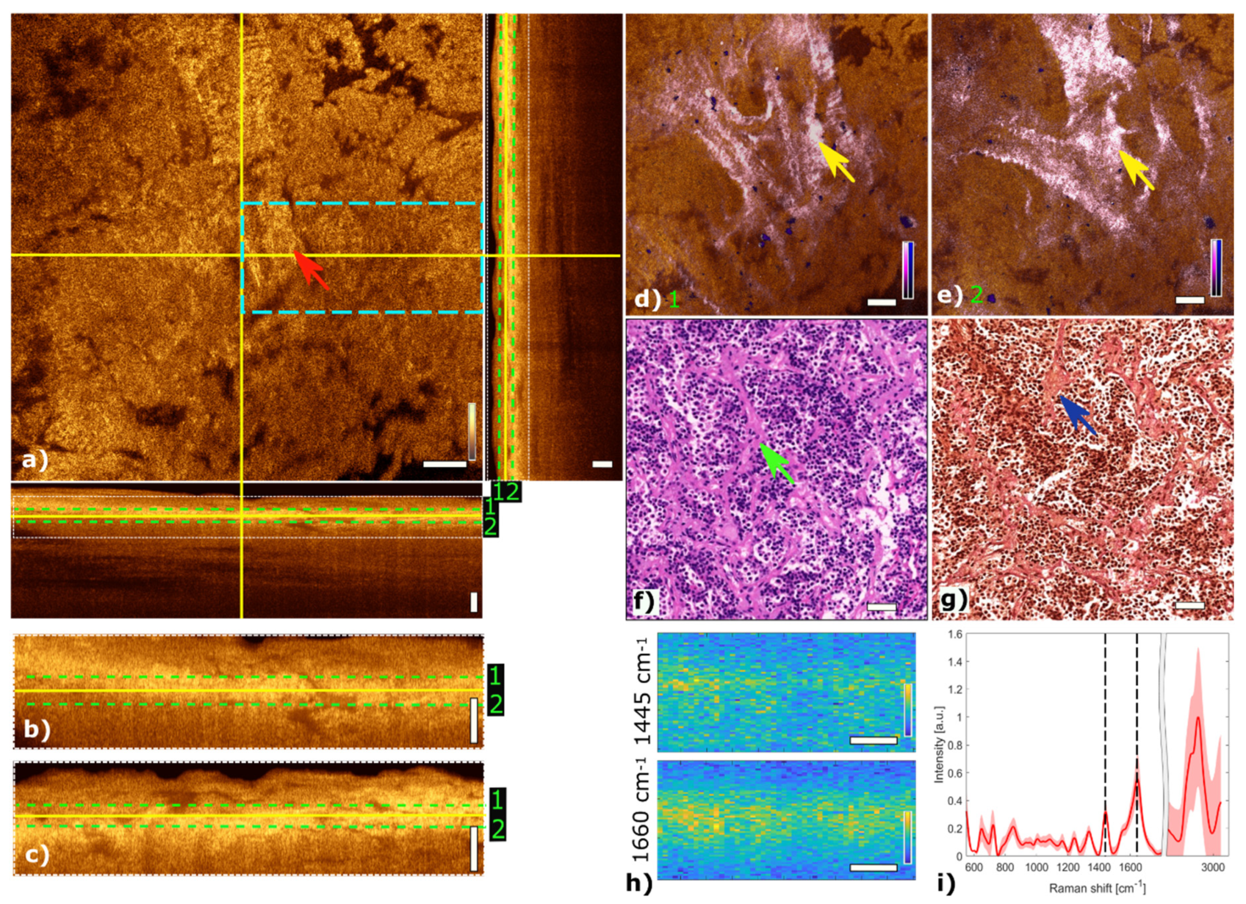Cancers 13 03234 g005
