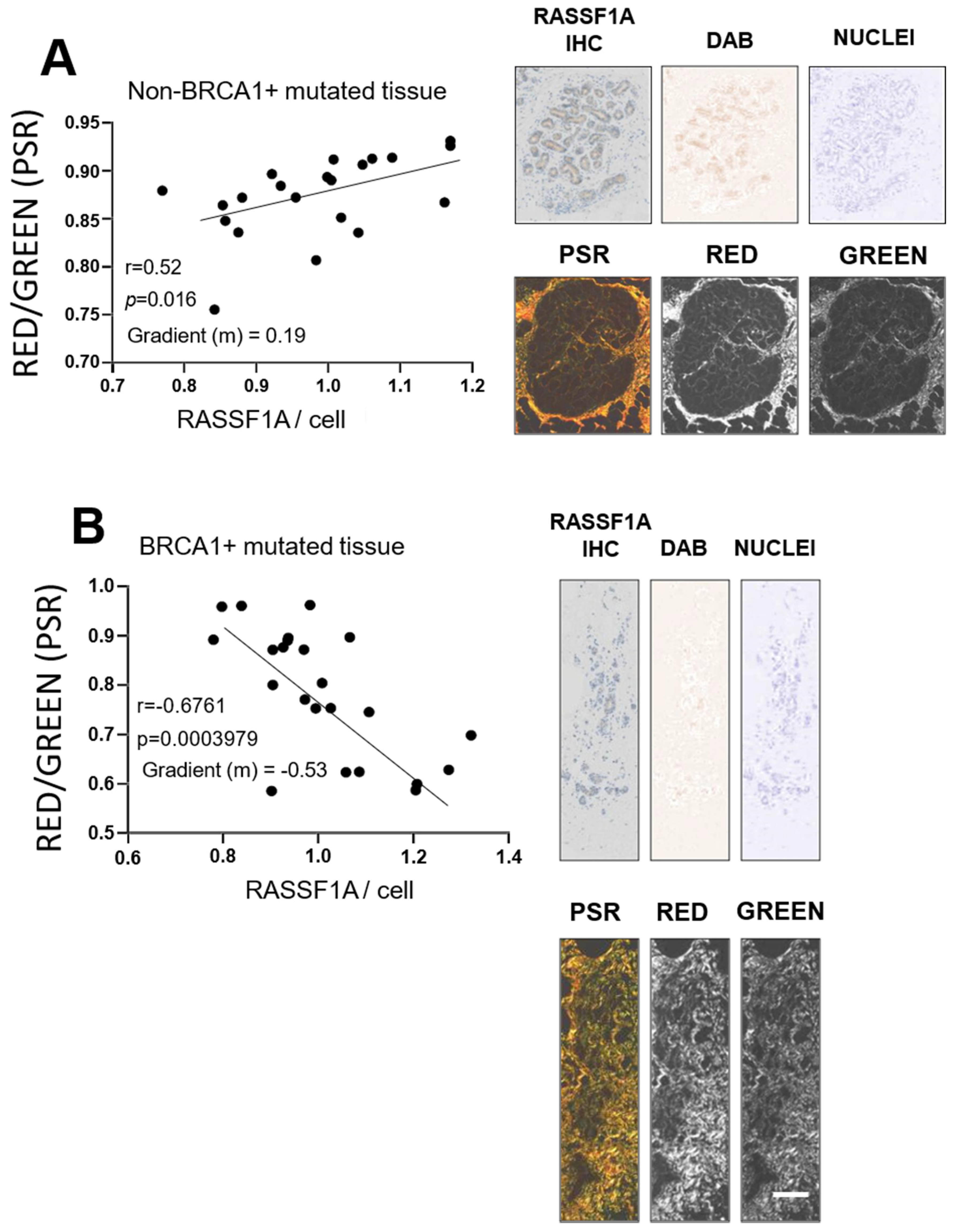 Cancers 13 03251 g004