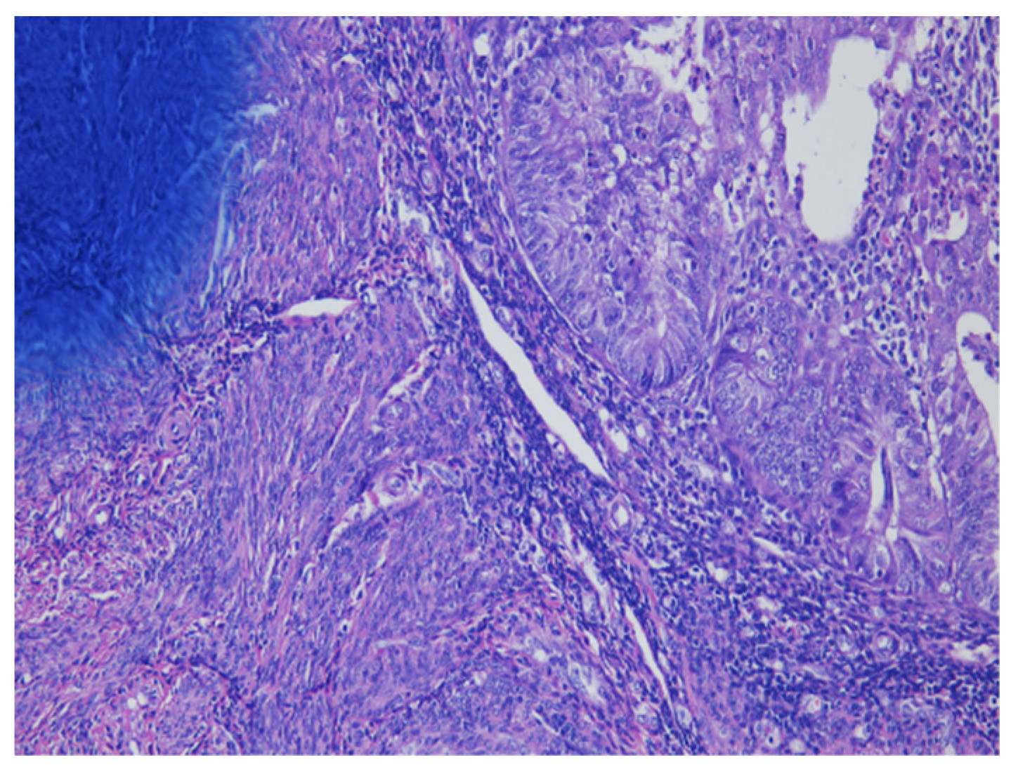 Cancers 13 03275 g002 Cancers 13 03275 g002