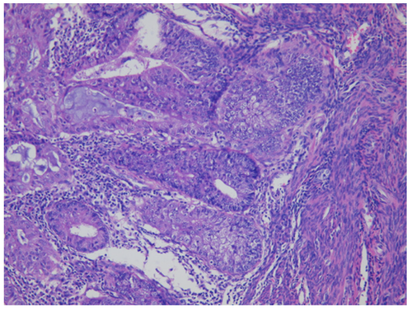 Cancers 13 03275 g003 Cancers 13 03275 g003