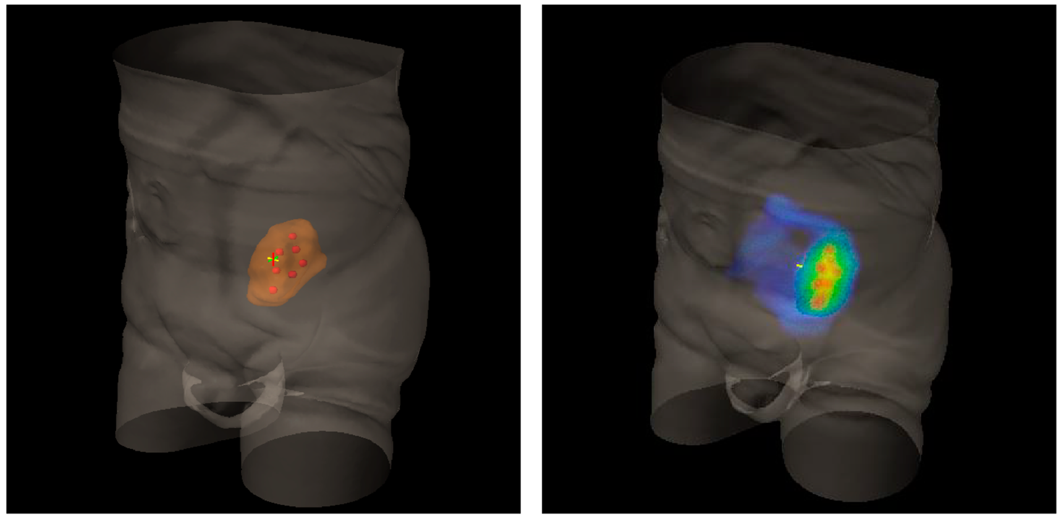 Cancers 13 03290 g002