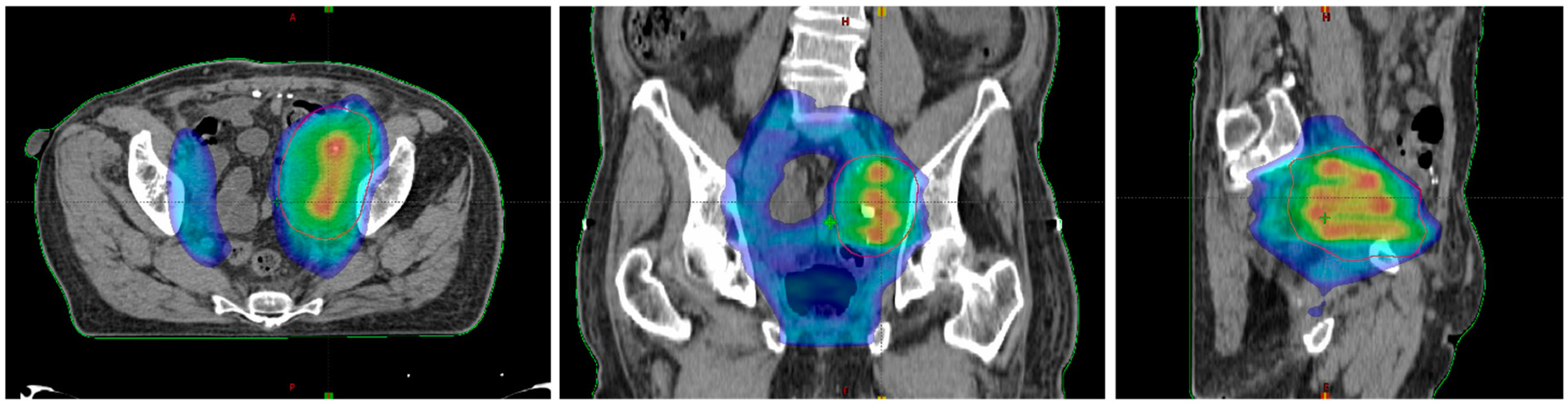 Cancers 13 03290 g003