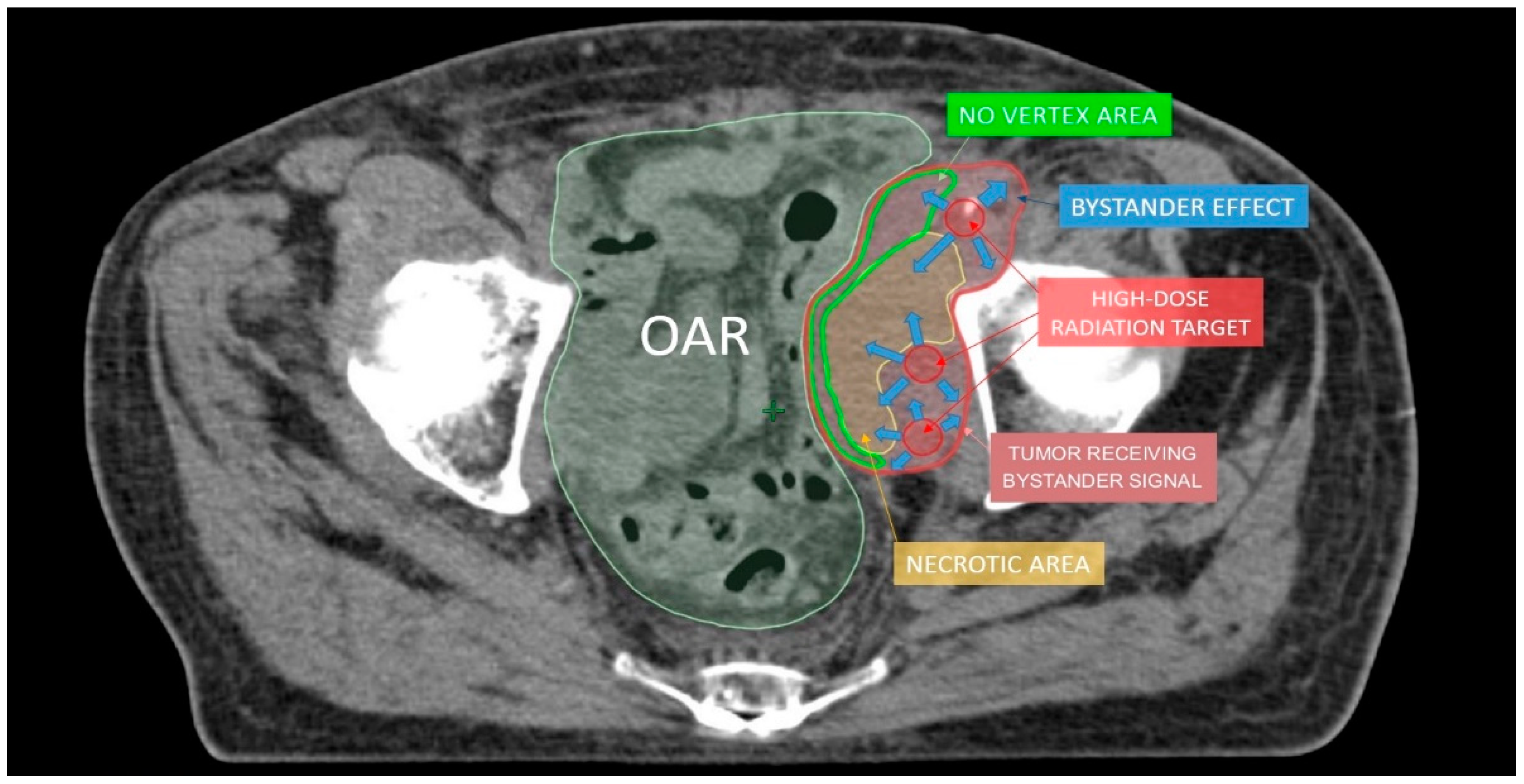 Cancers 13 03290 g004