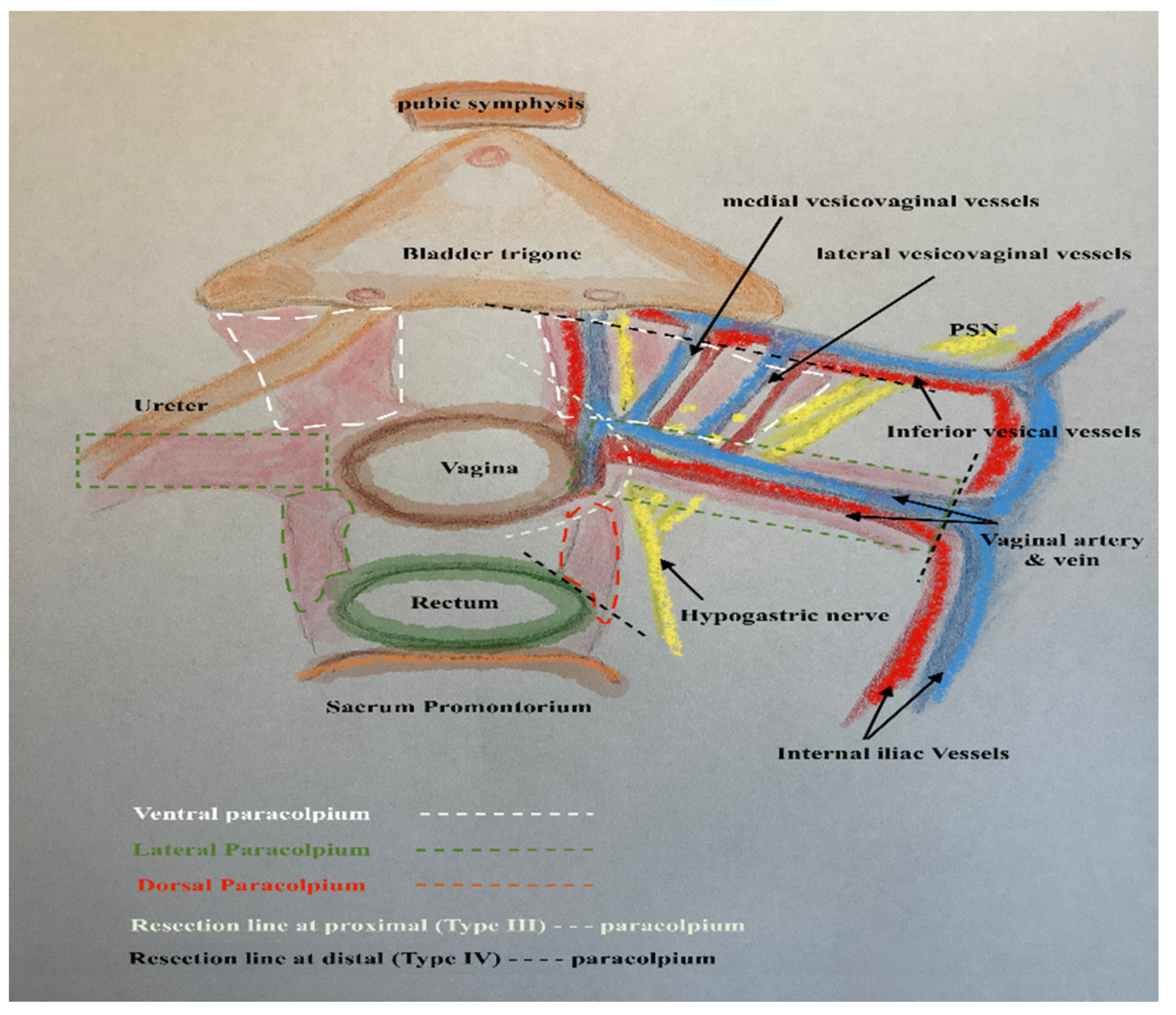 Cancers 13 03326 g004