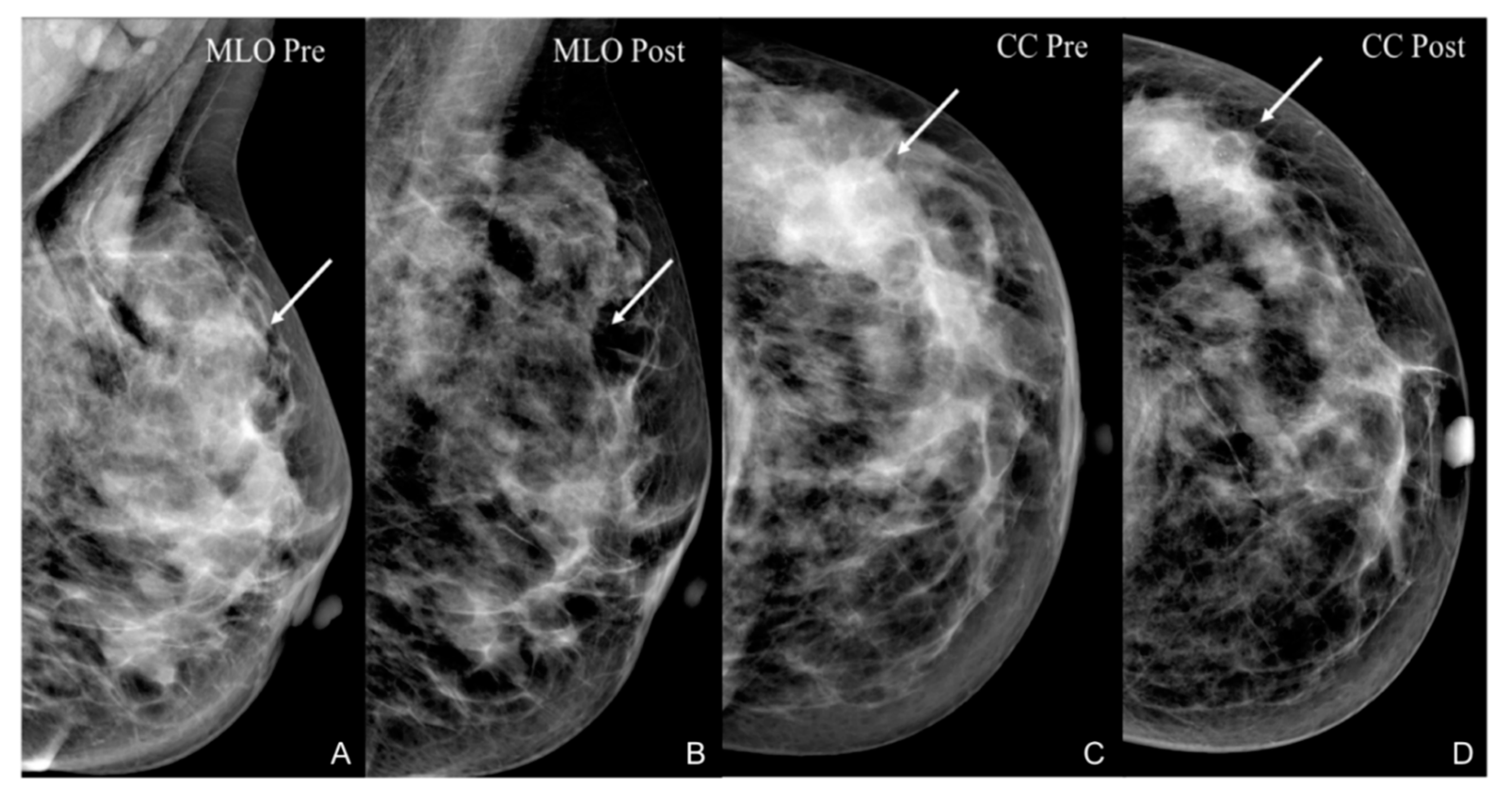 Cancers 13 03521 g001