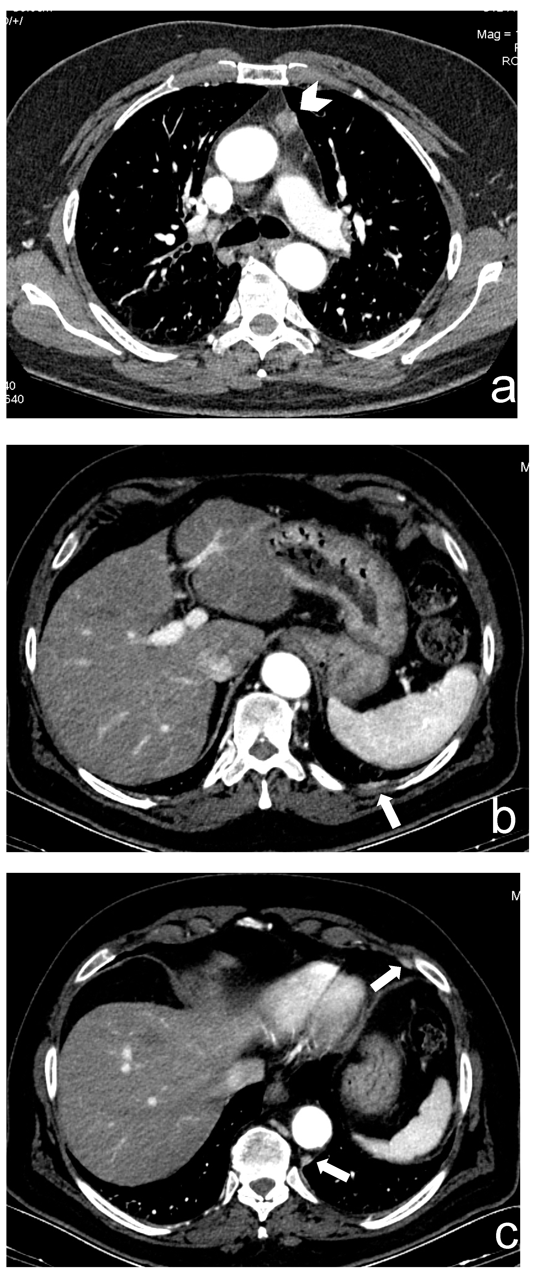 Cancers 13 03599 g001