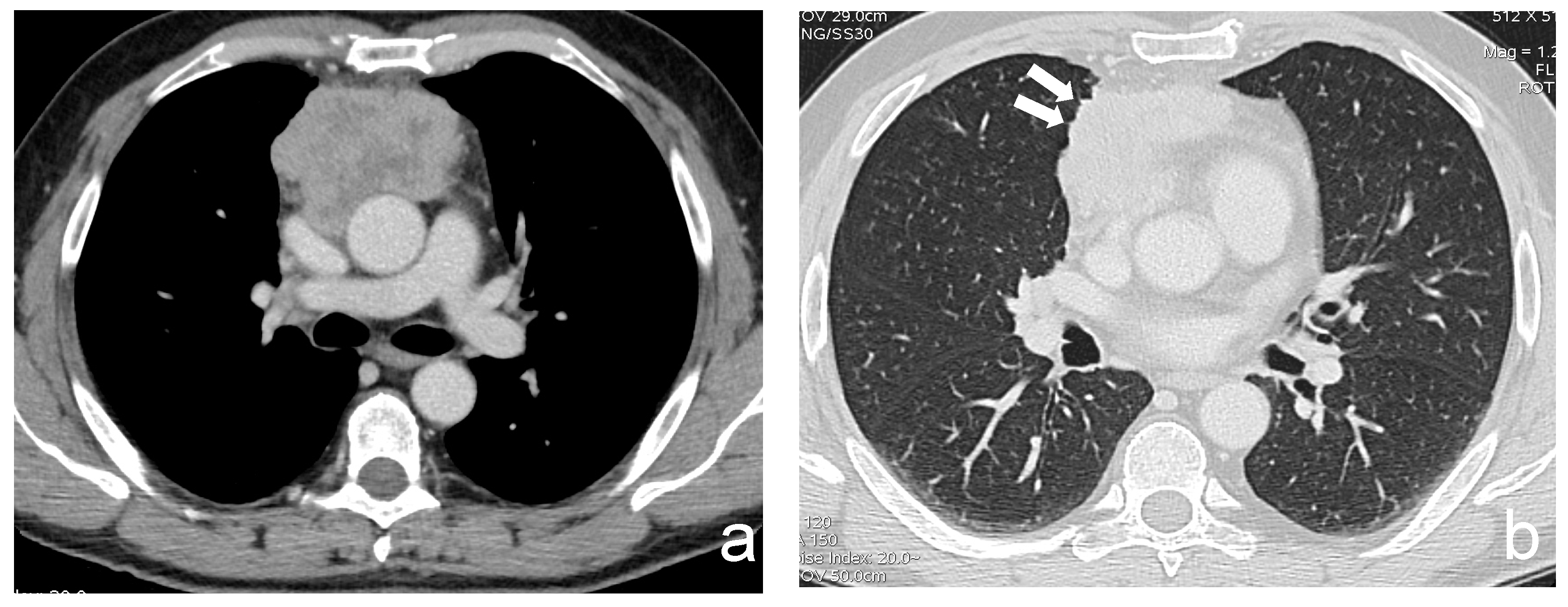 Cancers 13 03599 g002