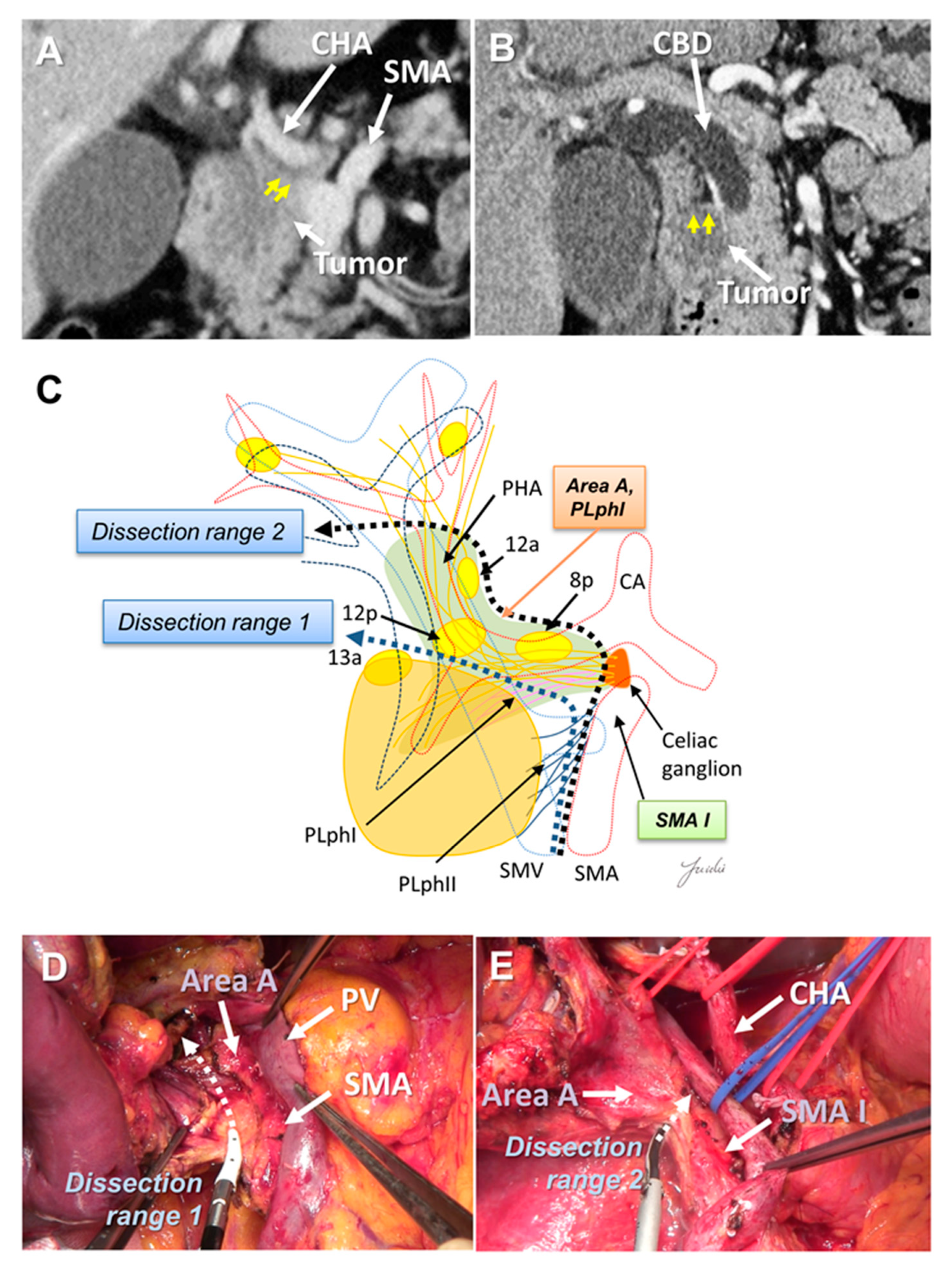 Cancers 13 03605 g002