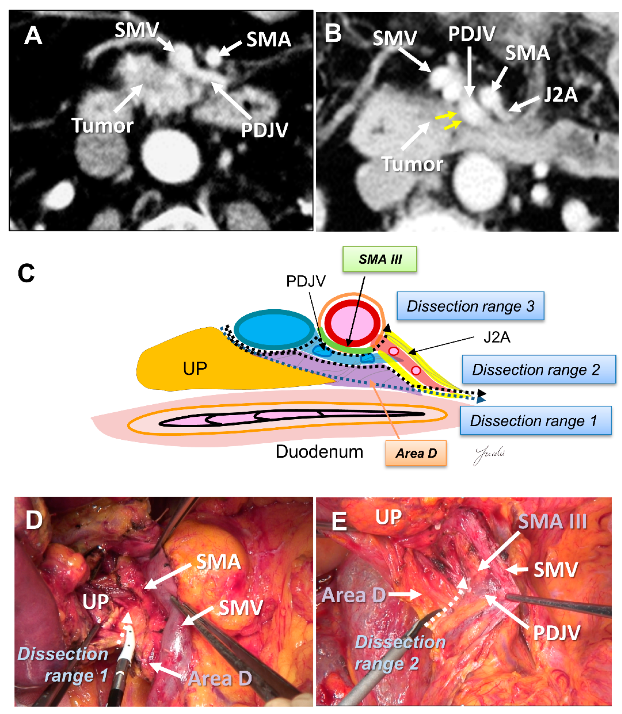 Cancers 13 03605 g005