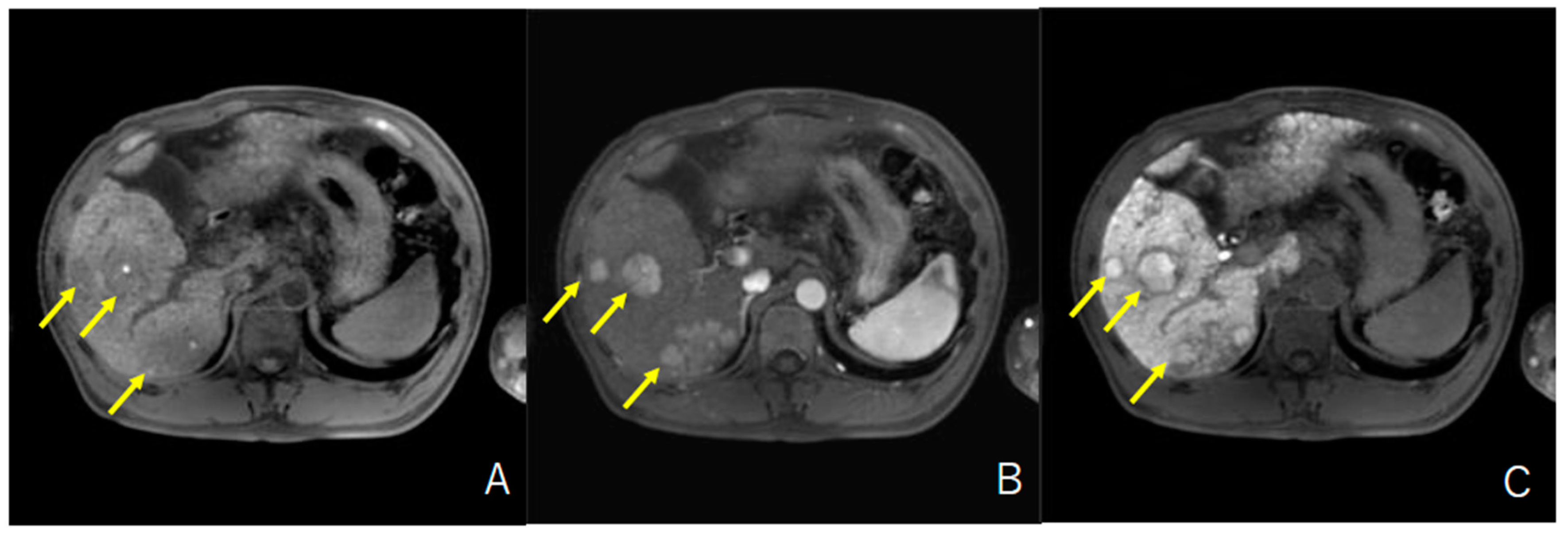 Cancers 13 03633 g002