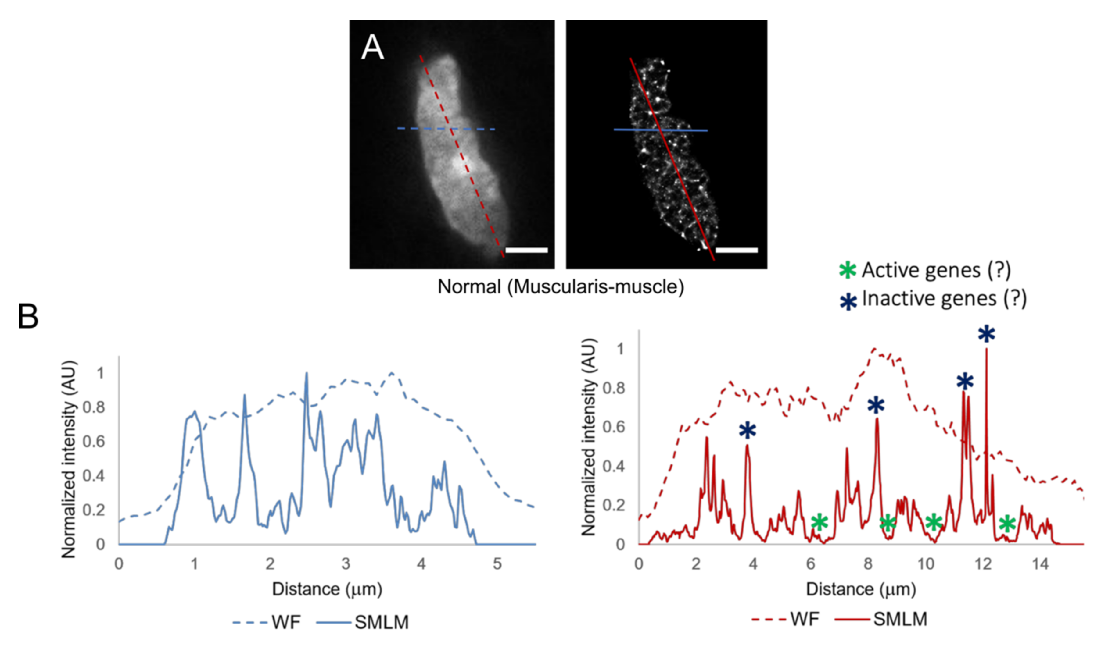 Cancers 13 03692 g004