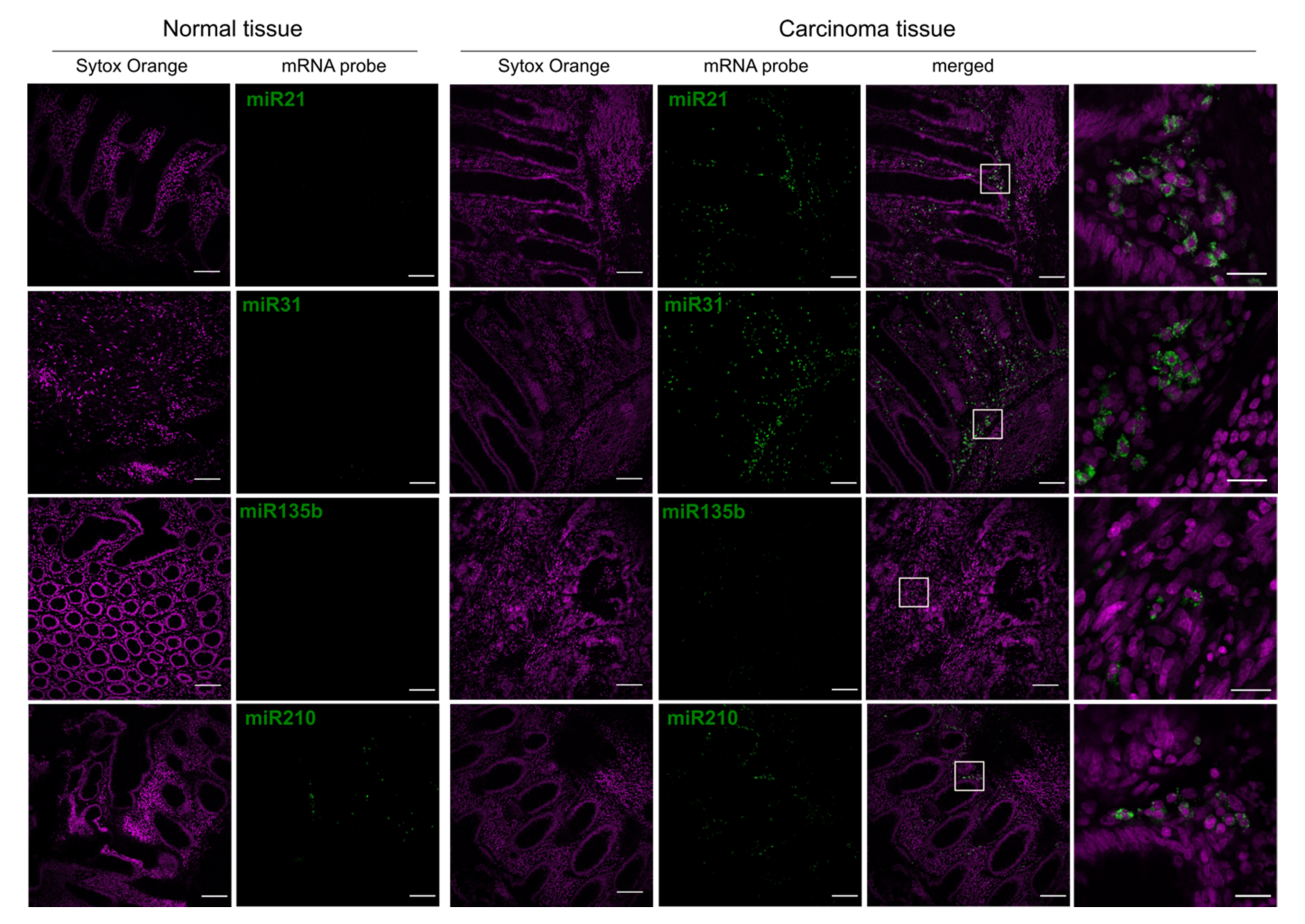 Cancers 13 03692 g008