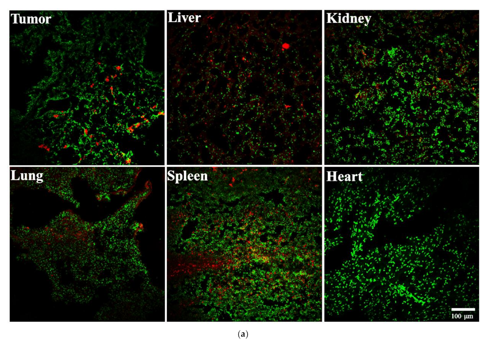 Cancers 13 03816 g005a