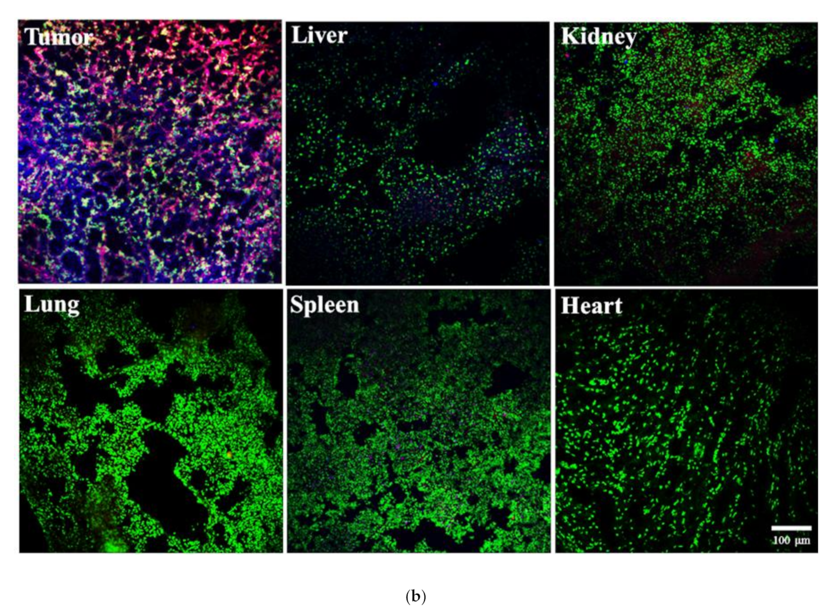 Cancers 13 03816 g005b