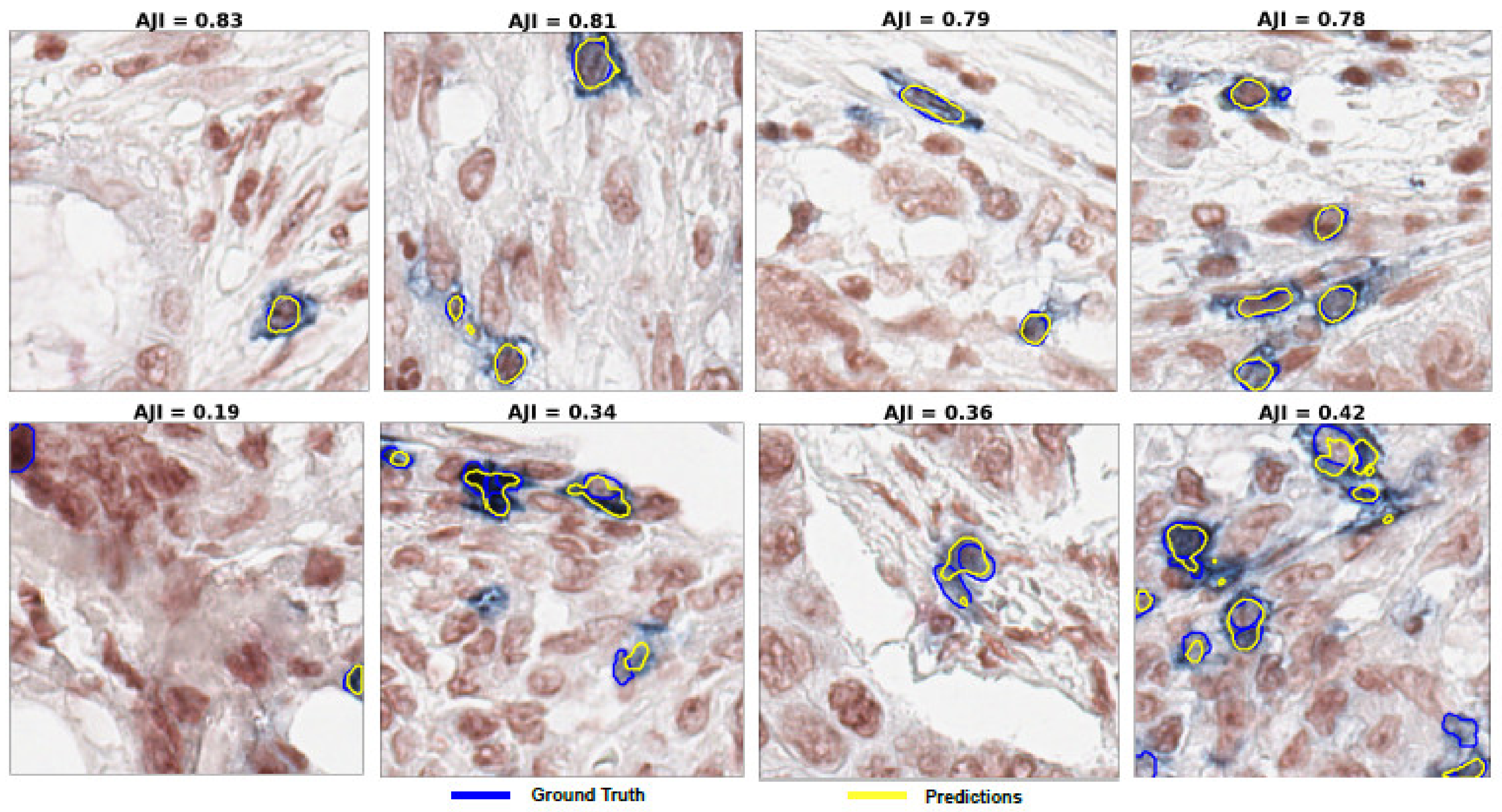Cancers 13 03825 g008