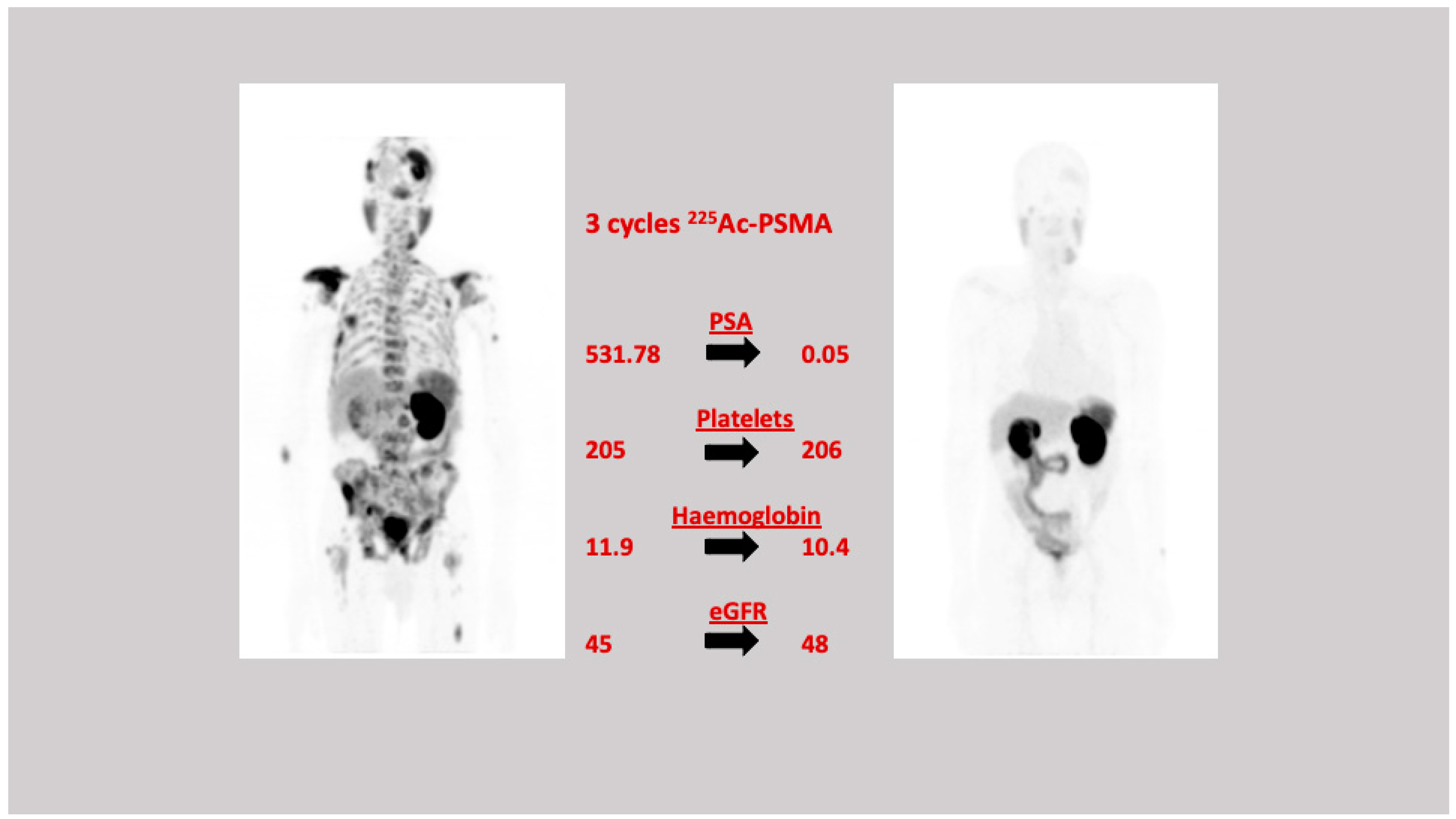 Cancers 13 03904 g003