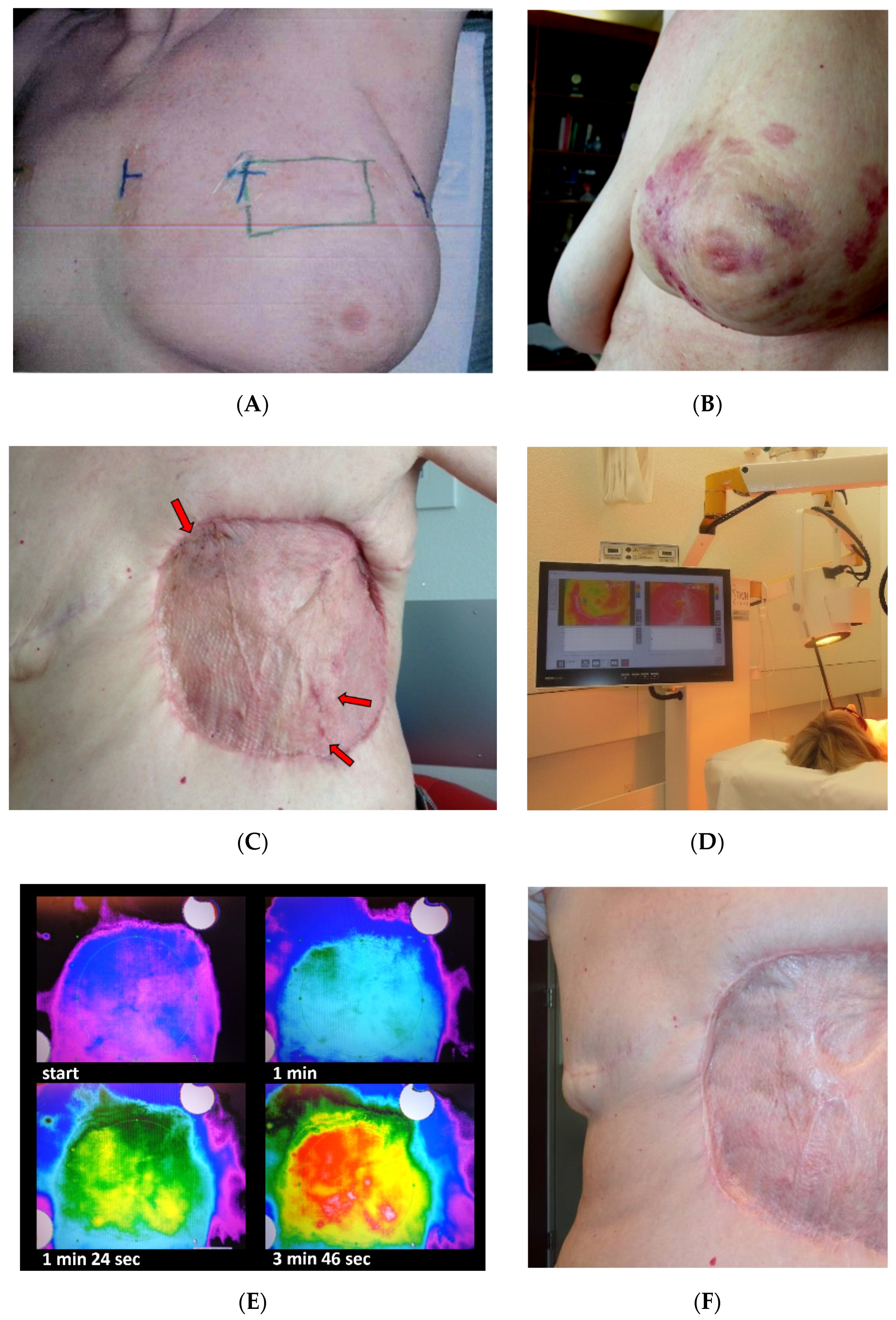 Cancers 13 03911 g002