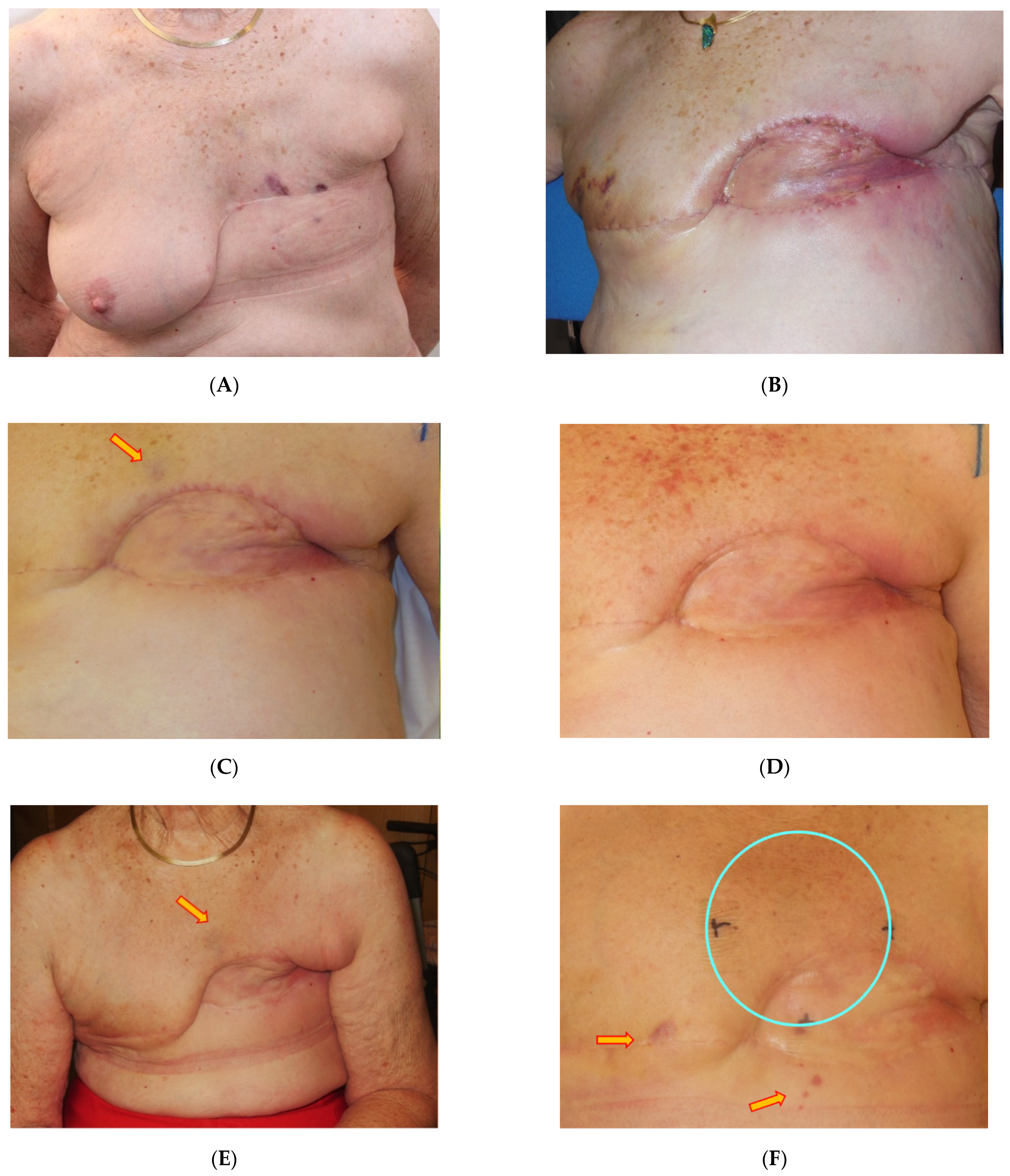 Cancers 13 03911 g004a