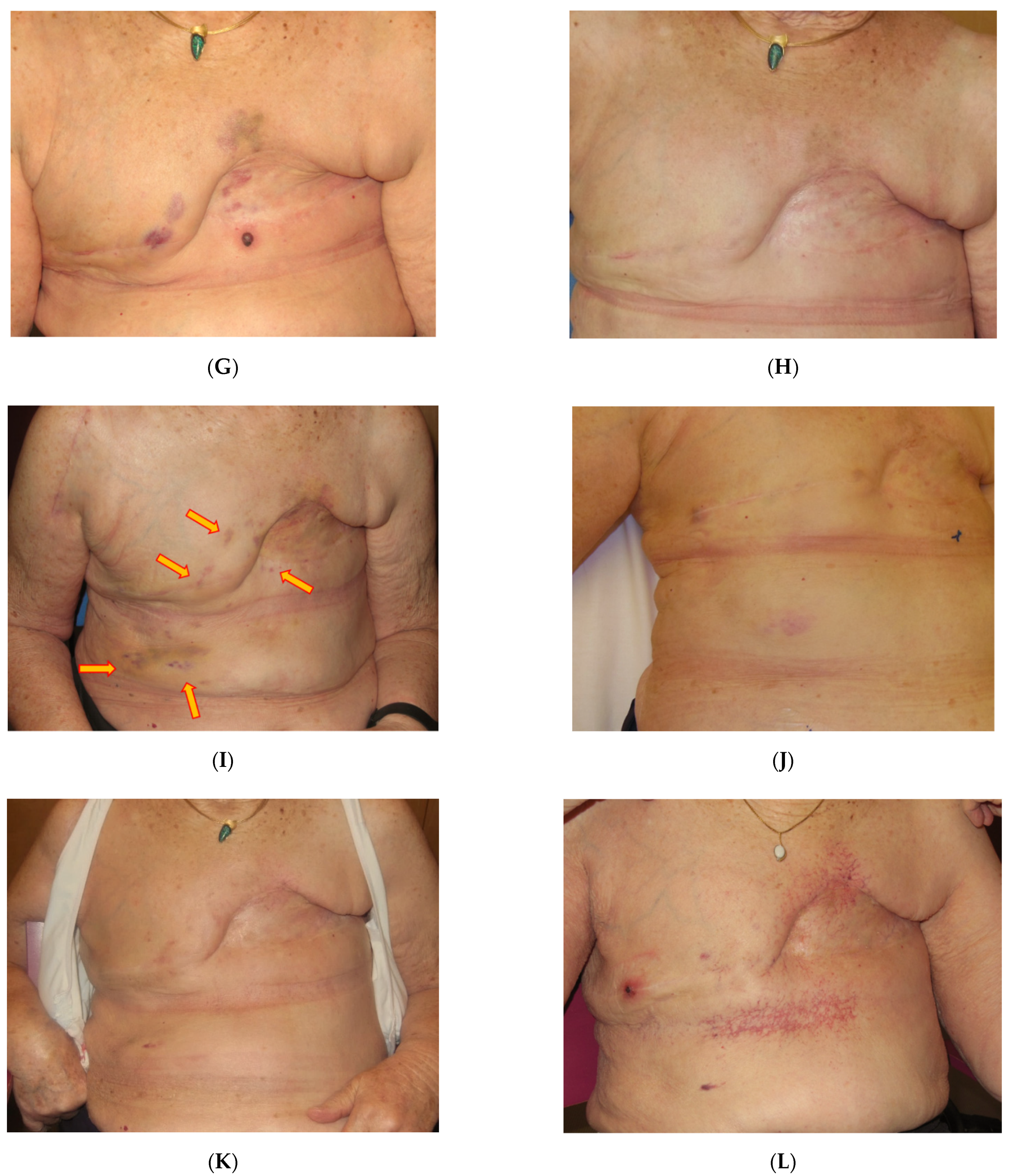 Cancers 13 03911 g004b