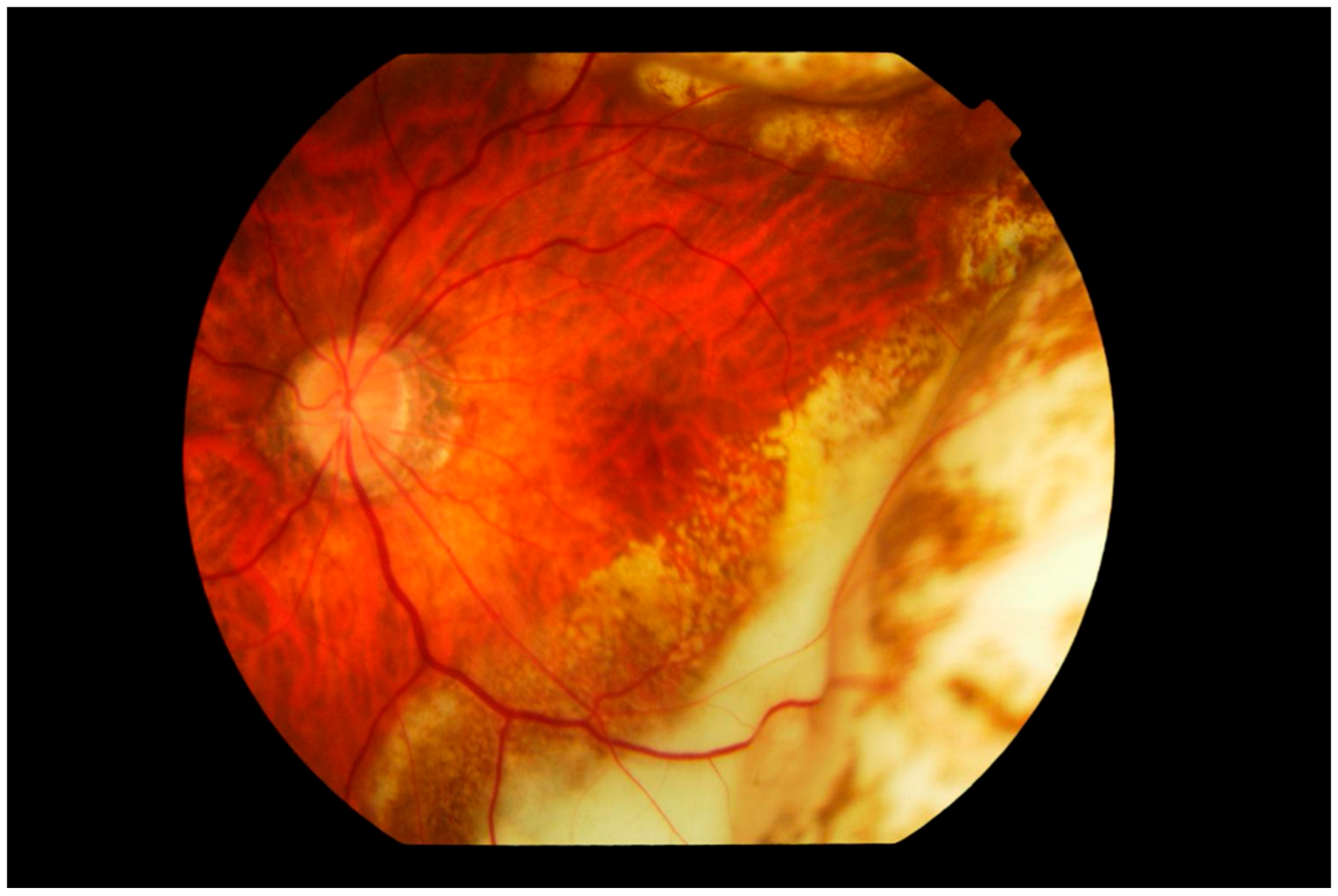 Cancers 13 03921 g003