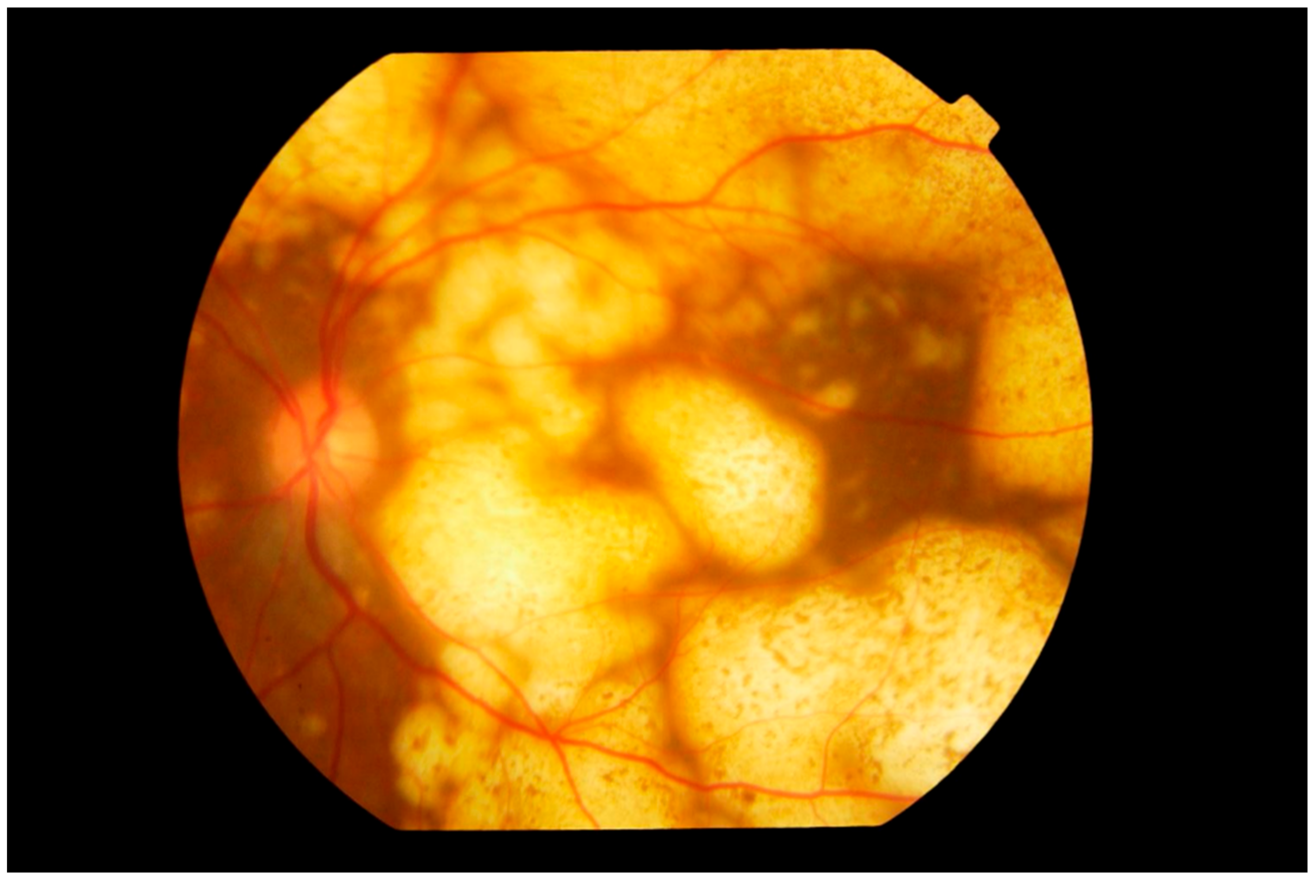 Cancers 13 03921 g004