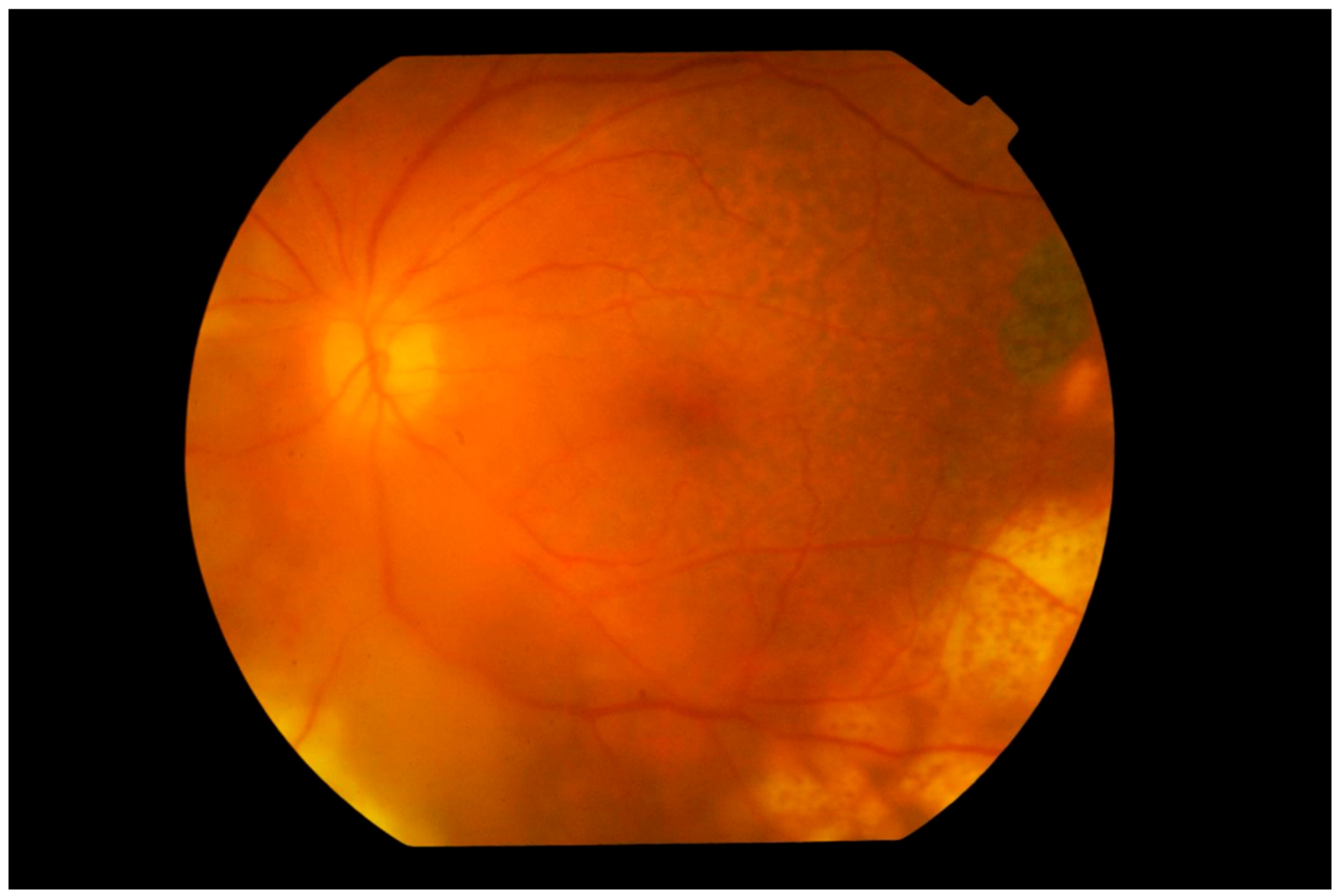 Cancers 13 03921 g005