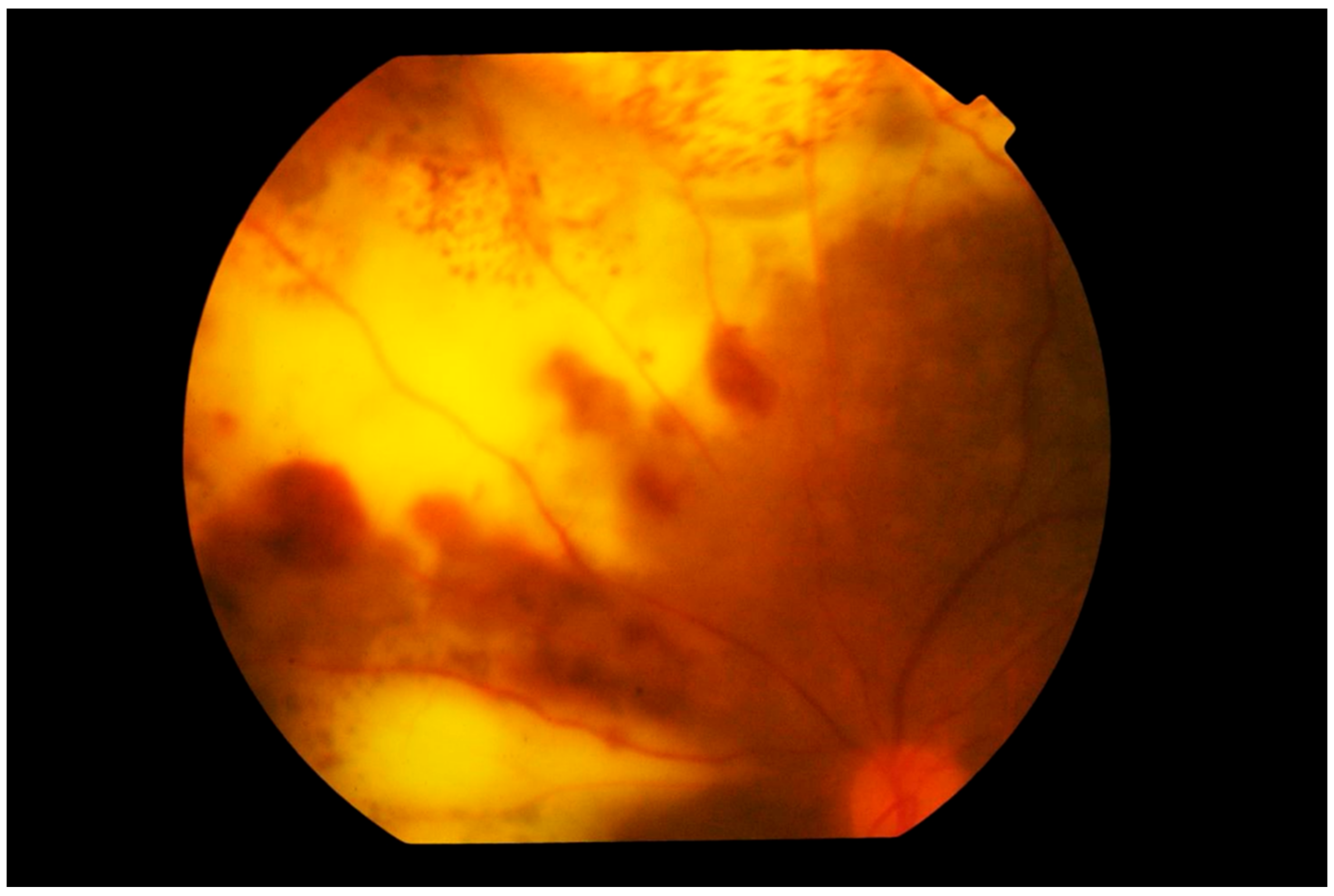 Cancers 13 03921 g006