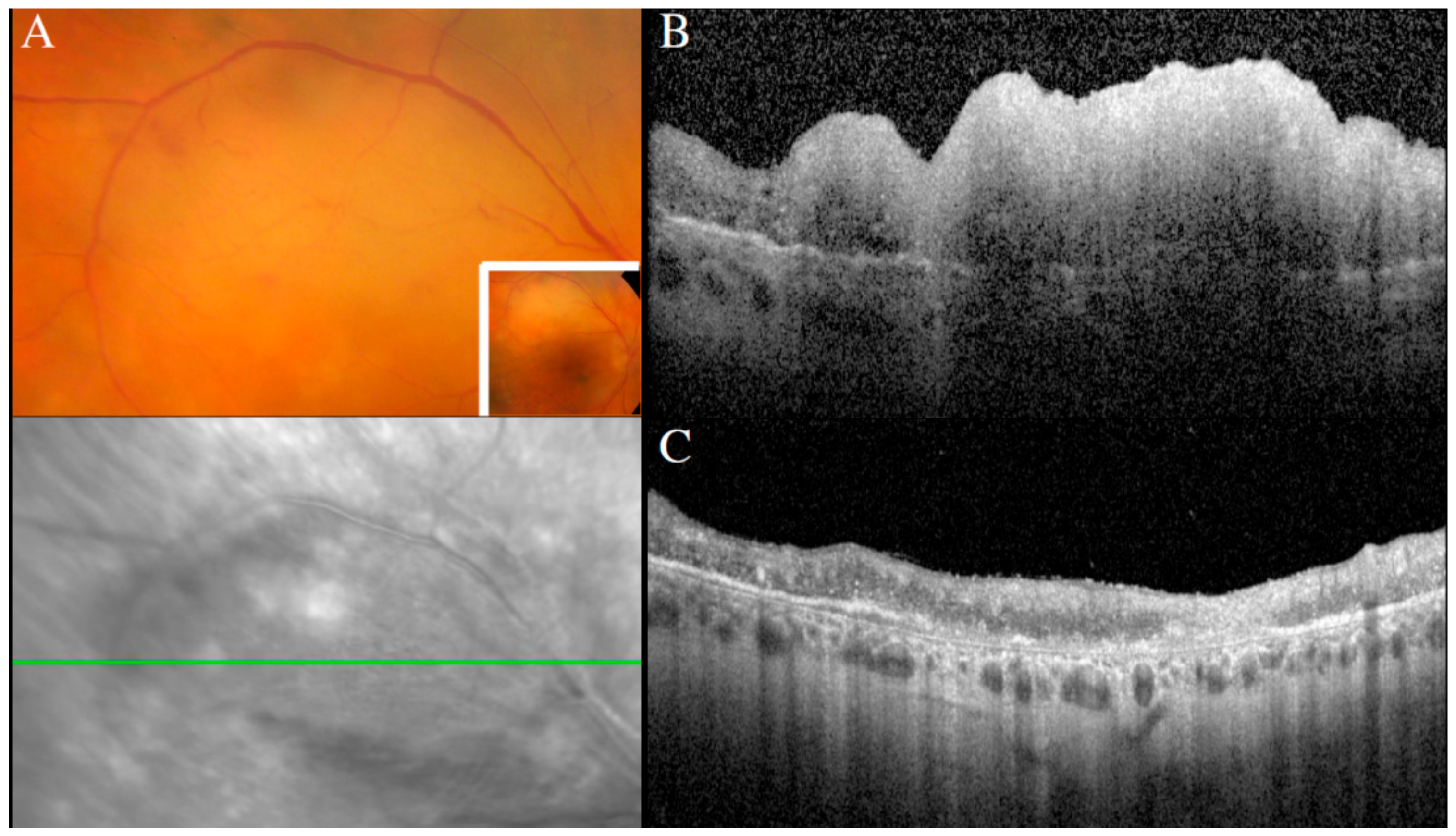 Cancers 13 03921 g009
