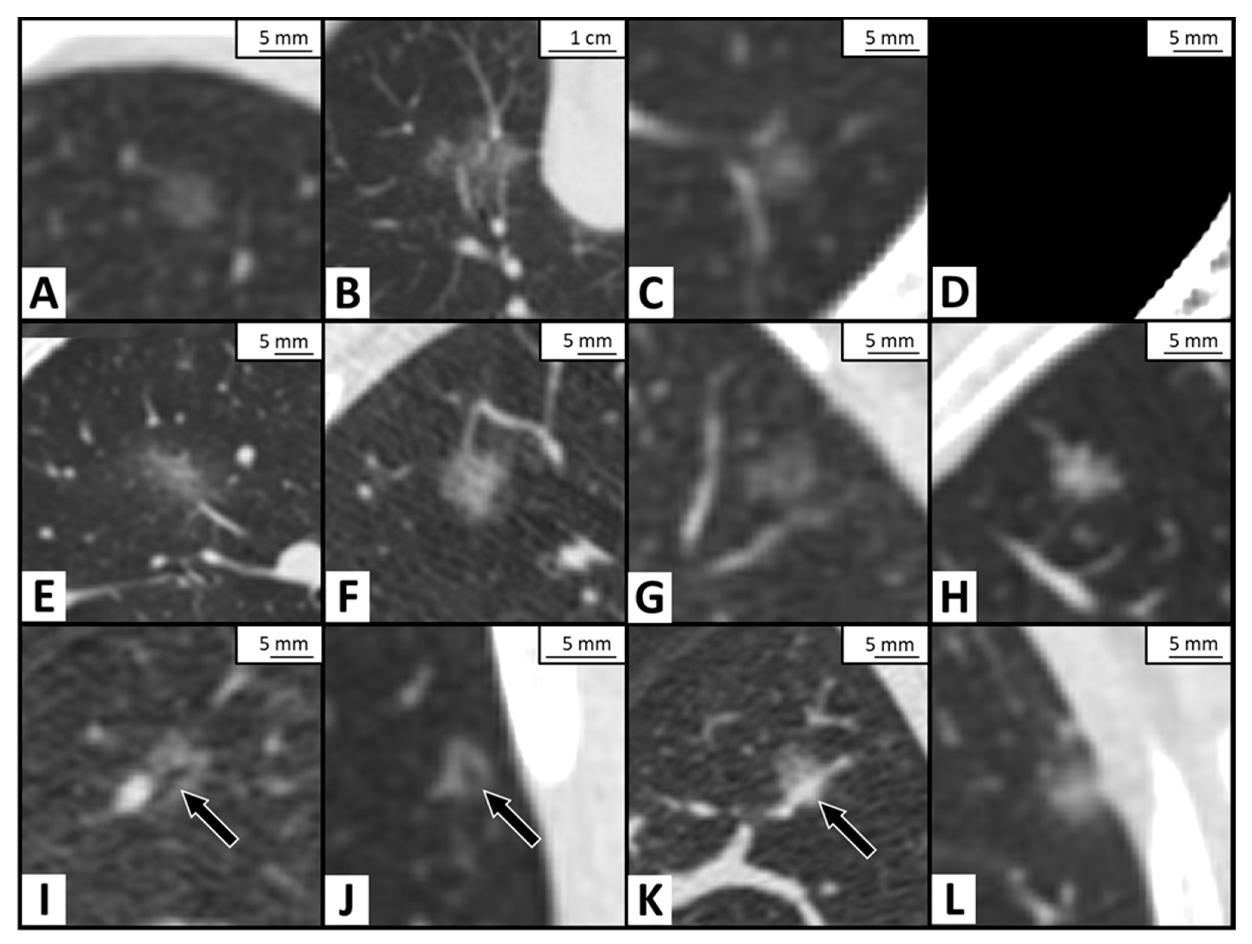 Cancers 13 03945 g002