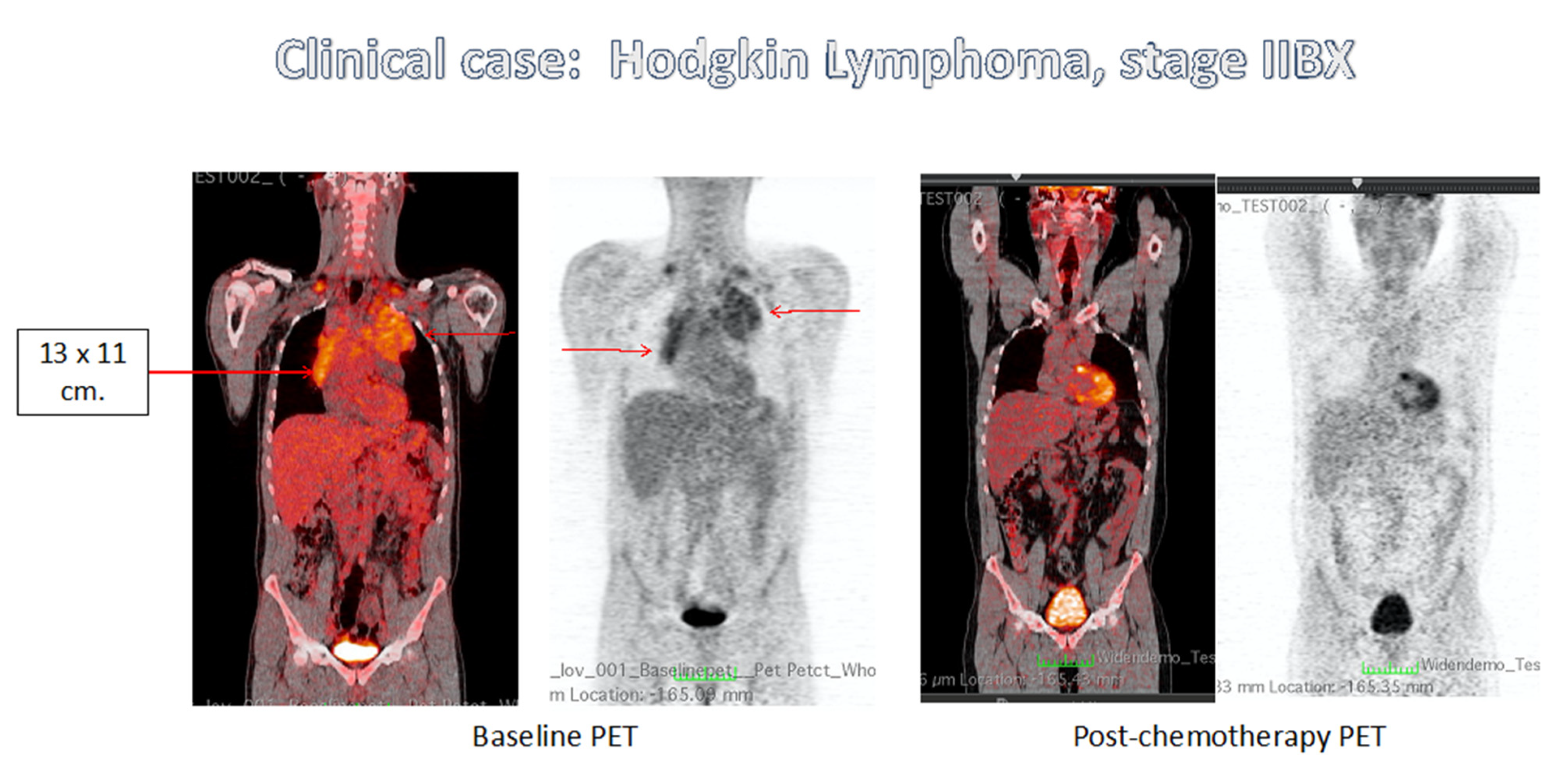 Cancers 13 03952 g001