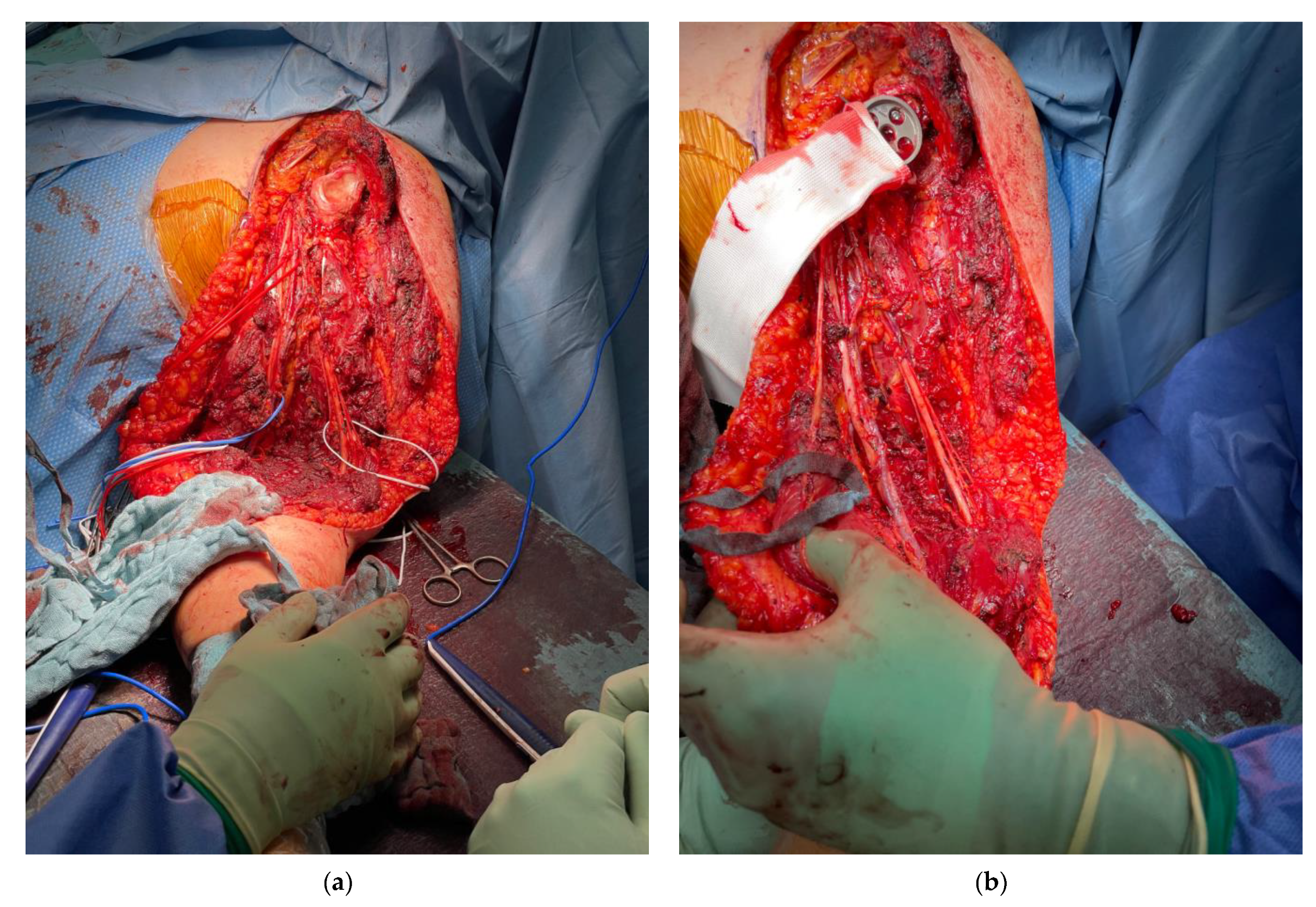 Cancers 13 03971 g003a