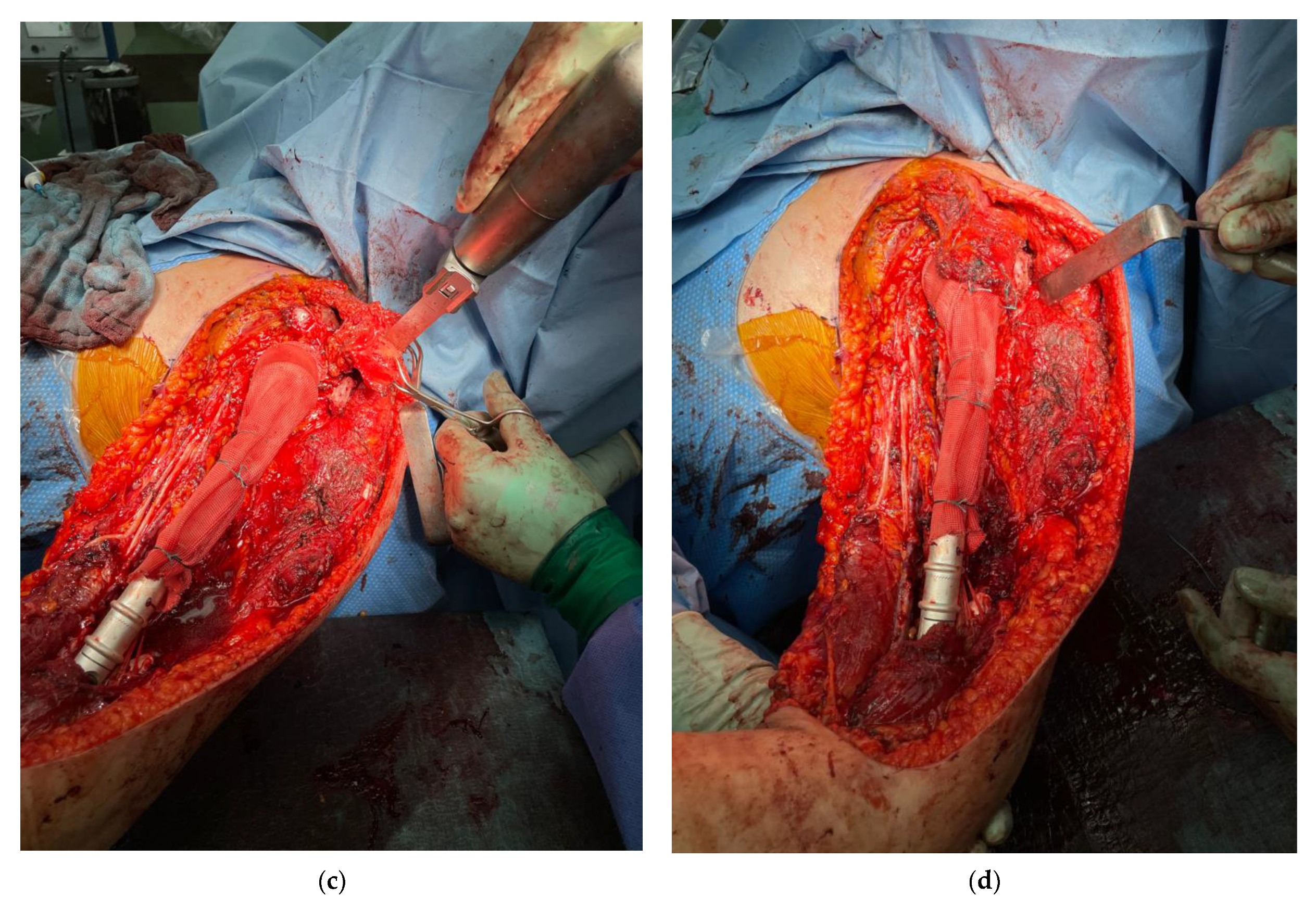 Cancers 13 03971 g003b