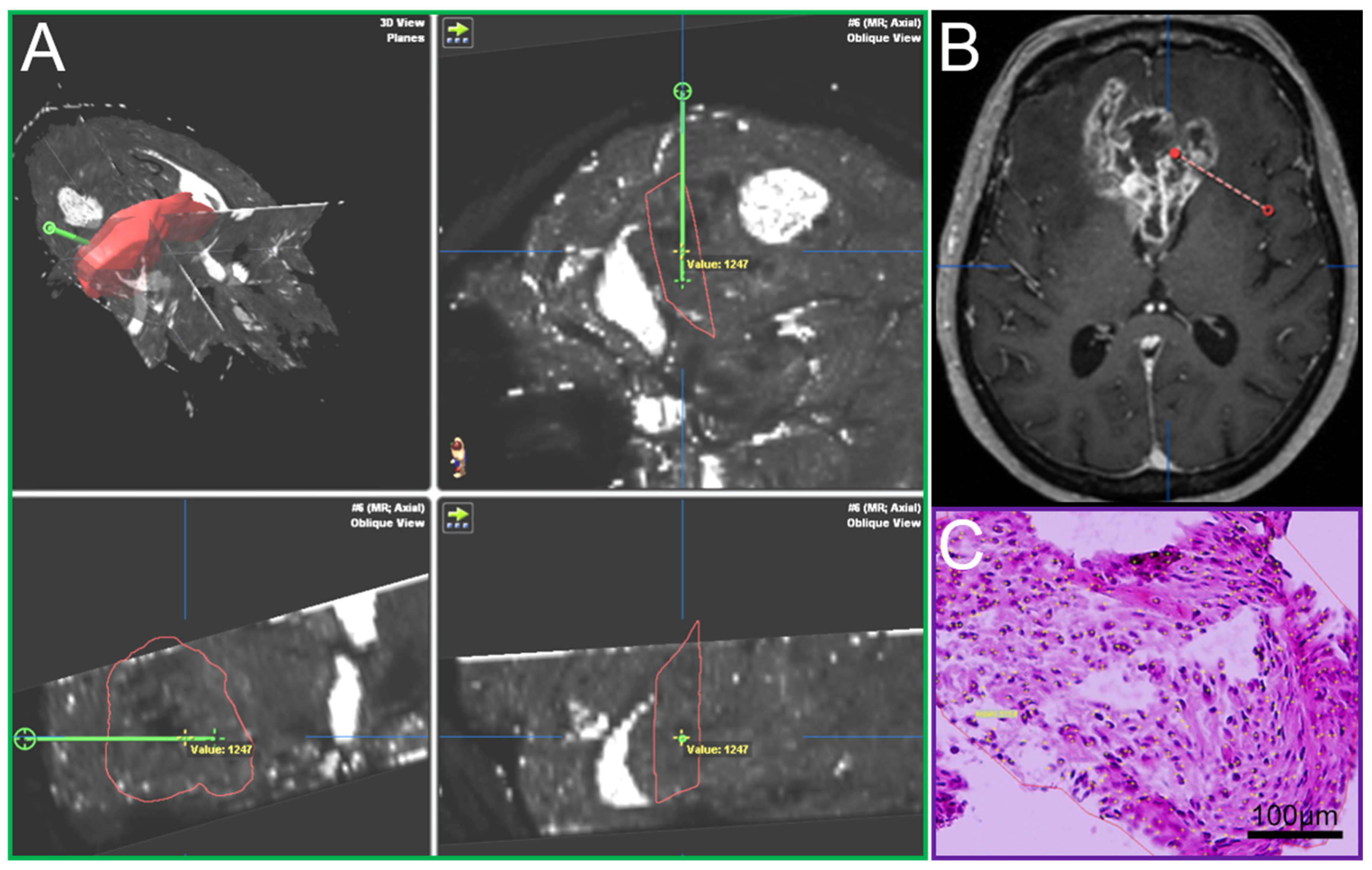 Cancers 13 04060 g001