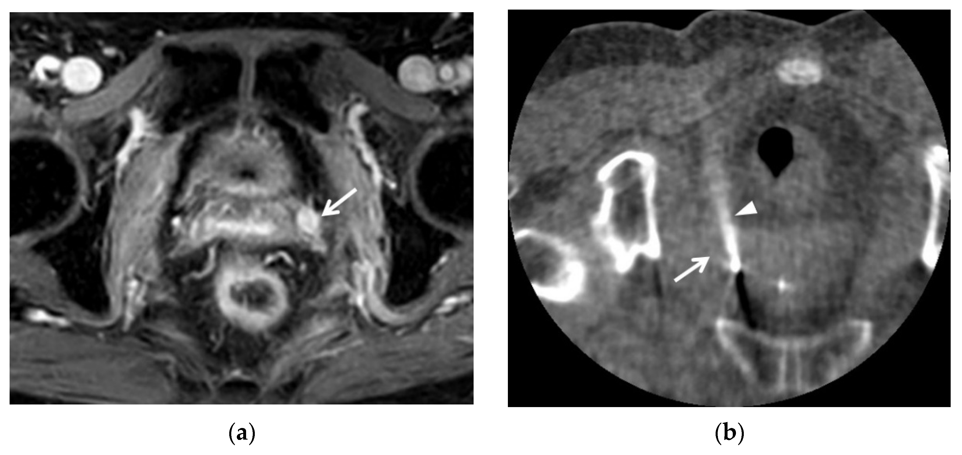 Cancers 13 04078 g005