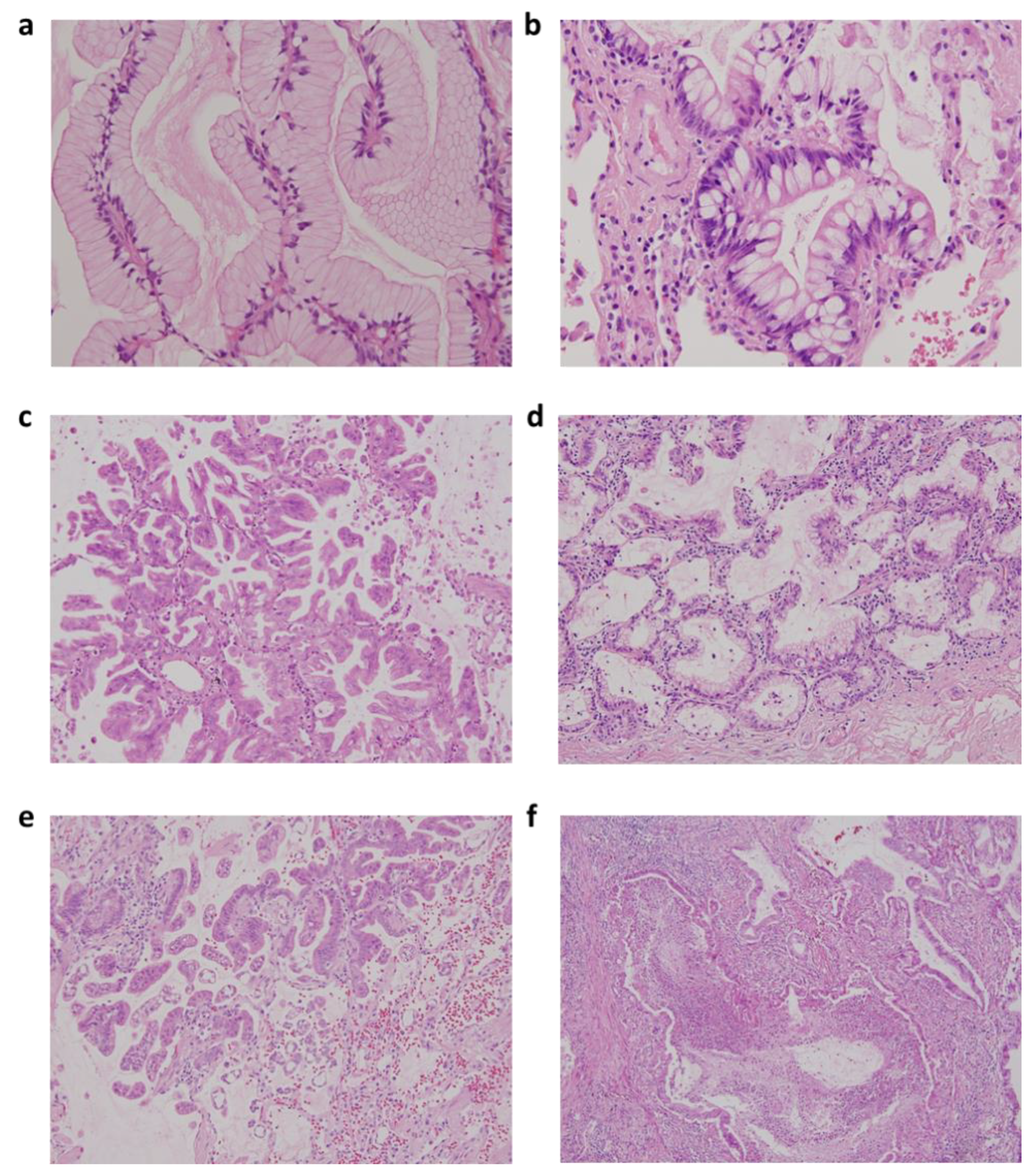 Cancers 13 04103 g001