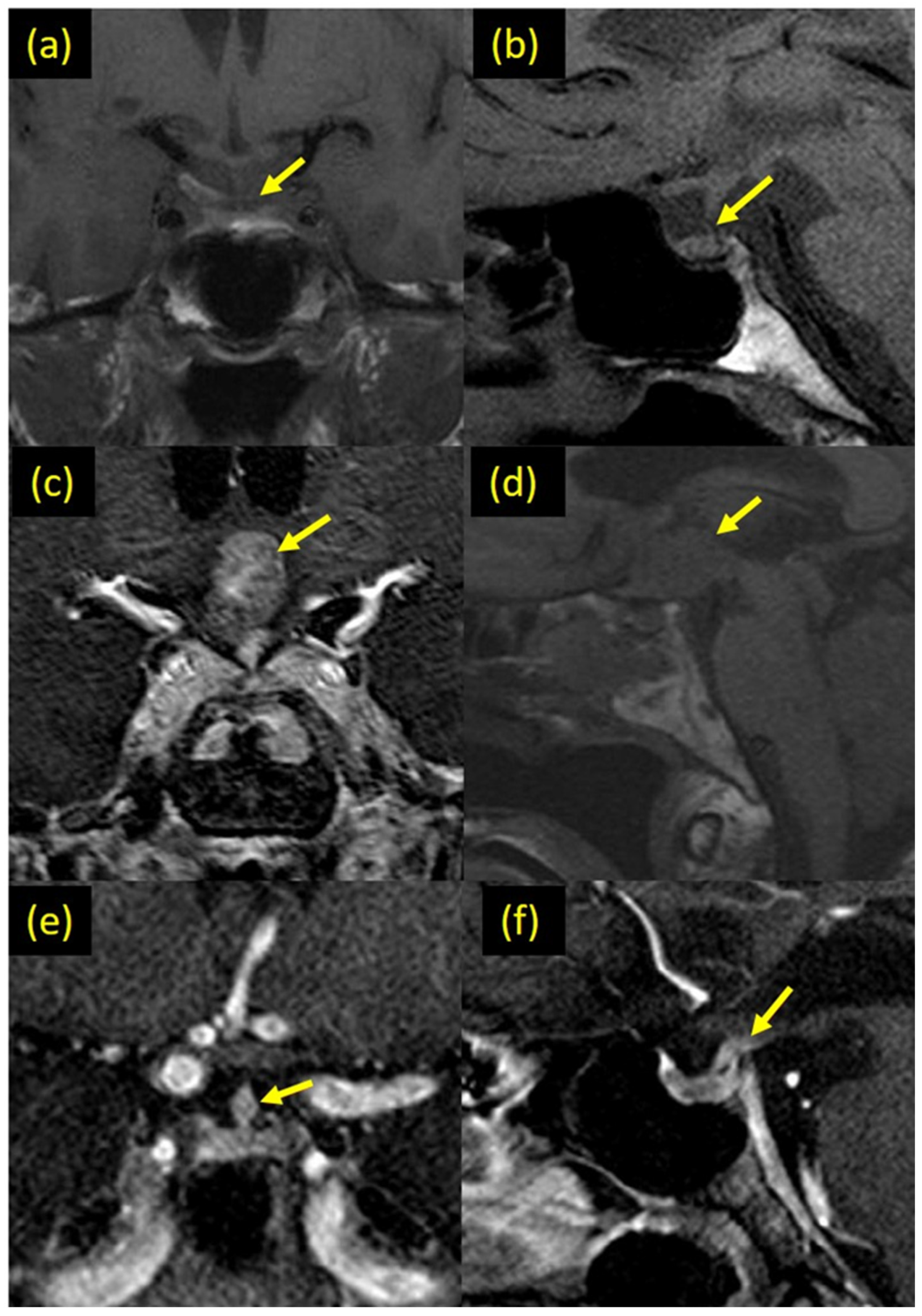 Cancers 13 04126 g001
