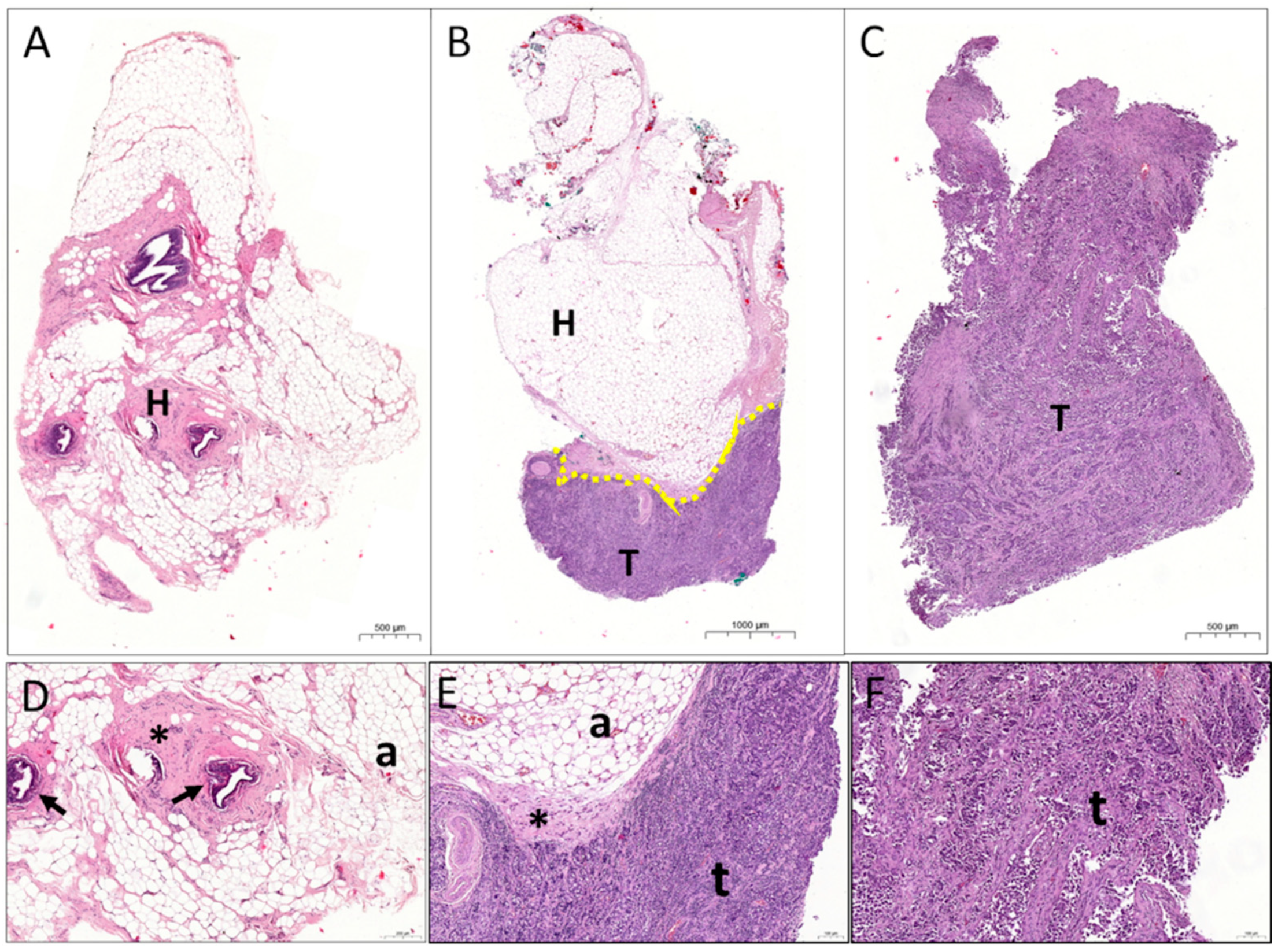 Cancers 13 04141 g001 Cancers 13 04141 g001