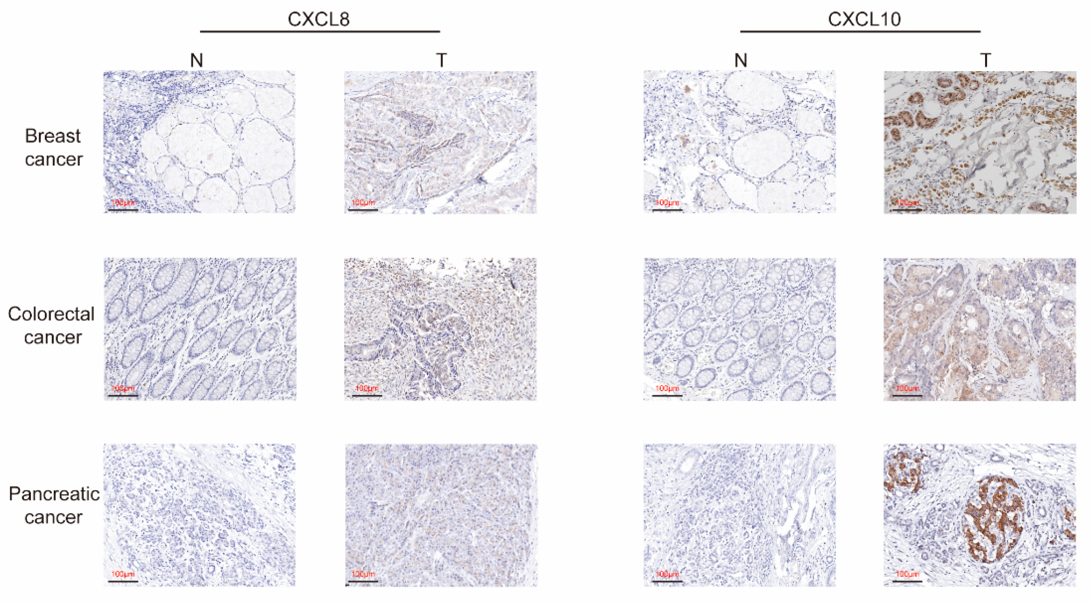 Cancers 13 04153 g006