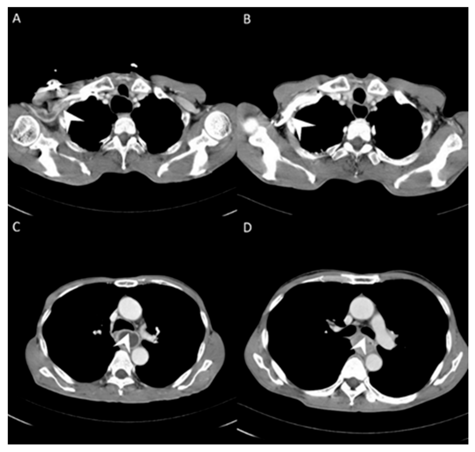 Cancers 13 04172 g001
