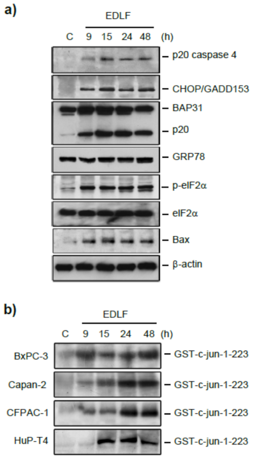 Cancers 13 04173 g009