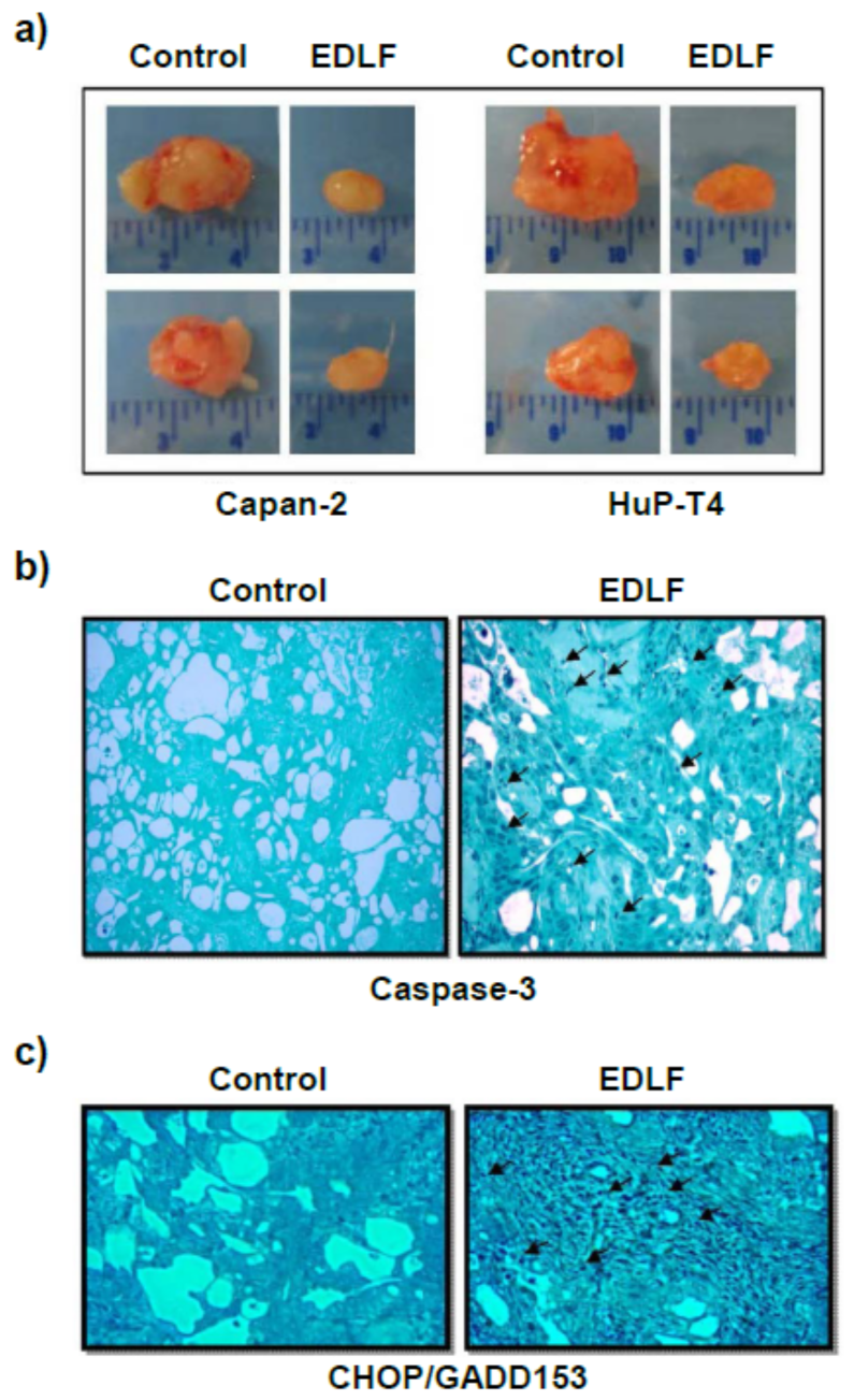 Cancers 13 04173 g010
