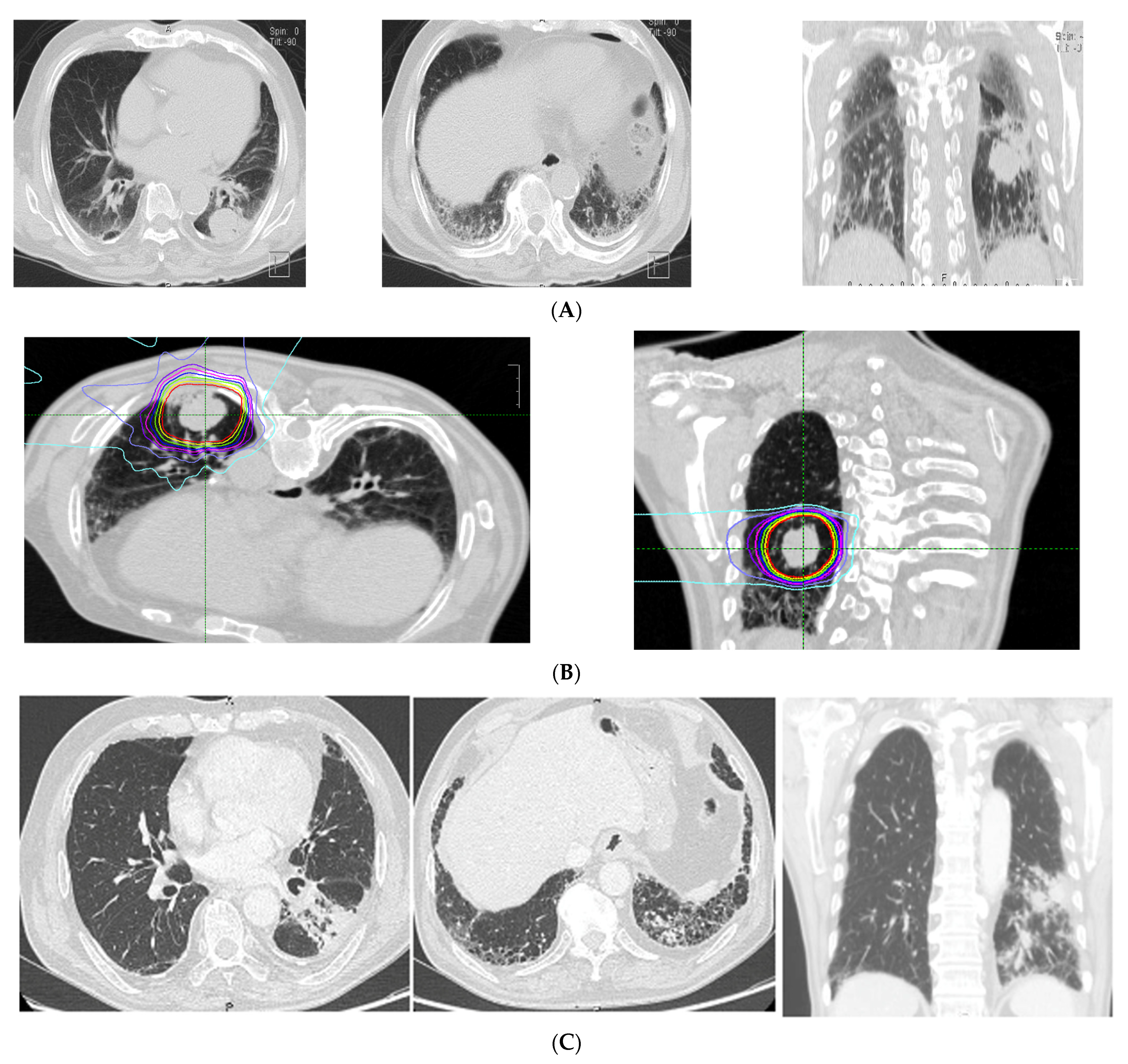 Cancers 13 04204 g001