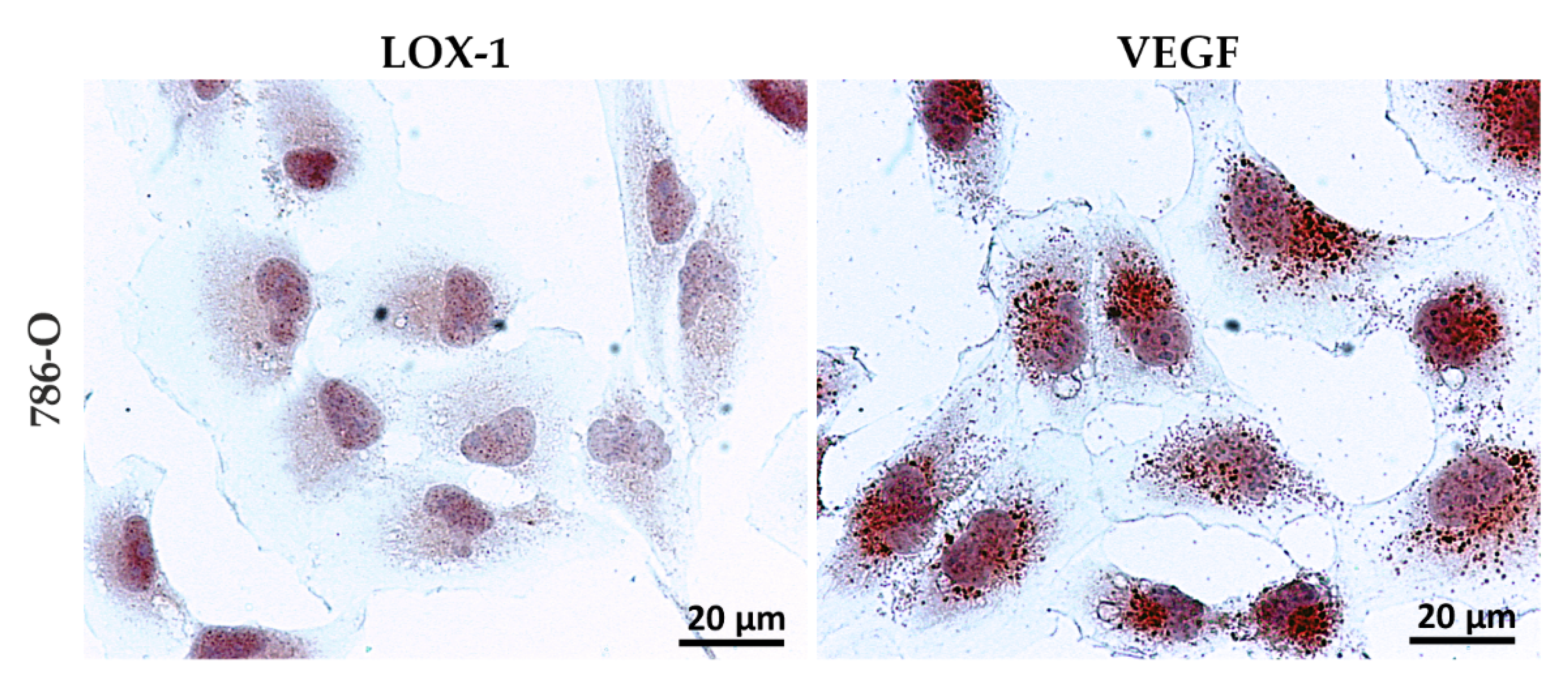 Cancers 13 04213 g001 Cancers 13 04213 g001