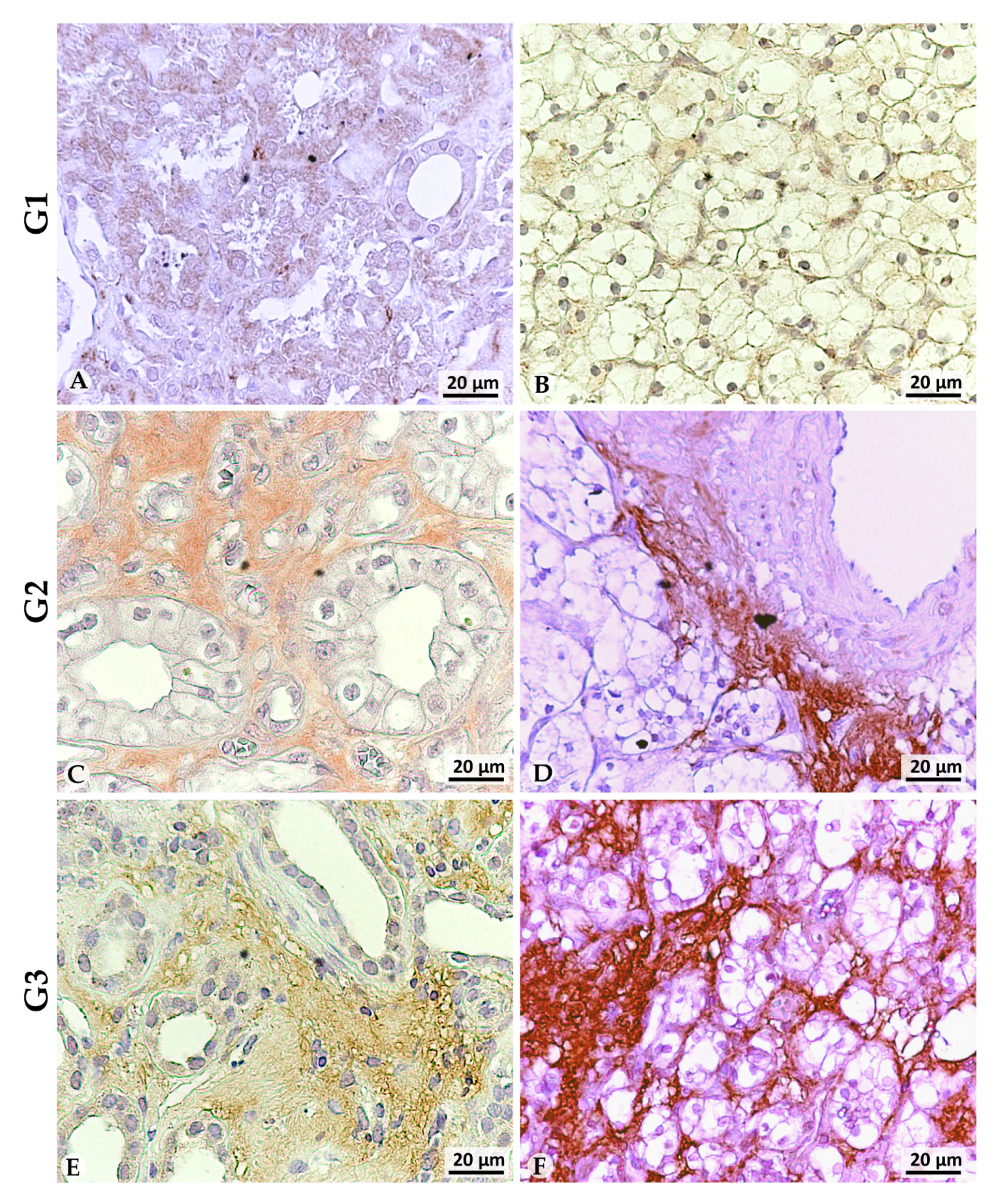 Cancers 13 04213 g003 Cancers 13 04213 g003