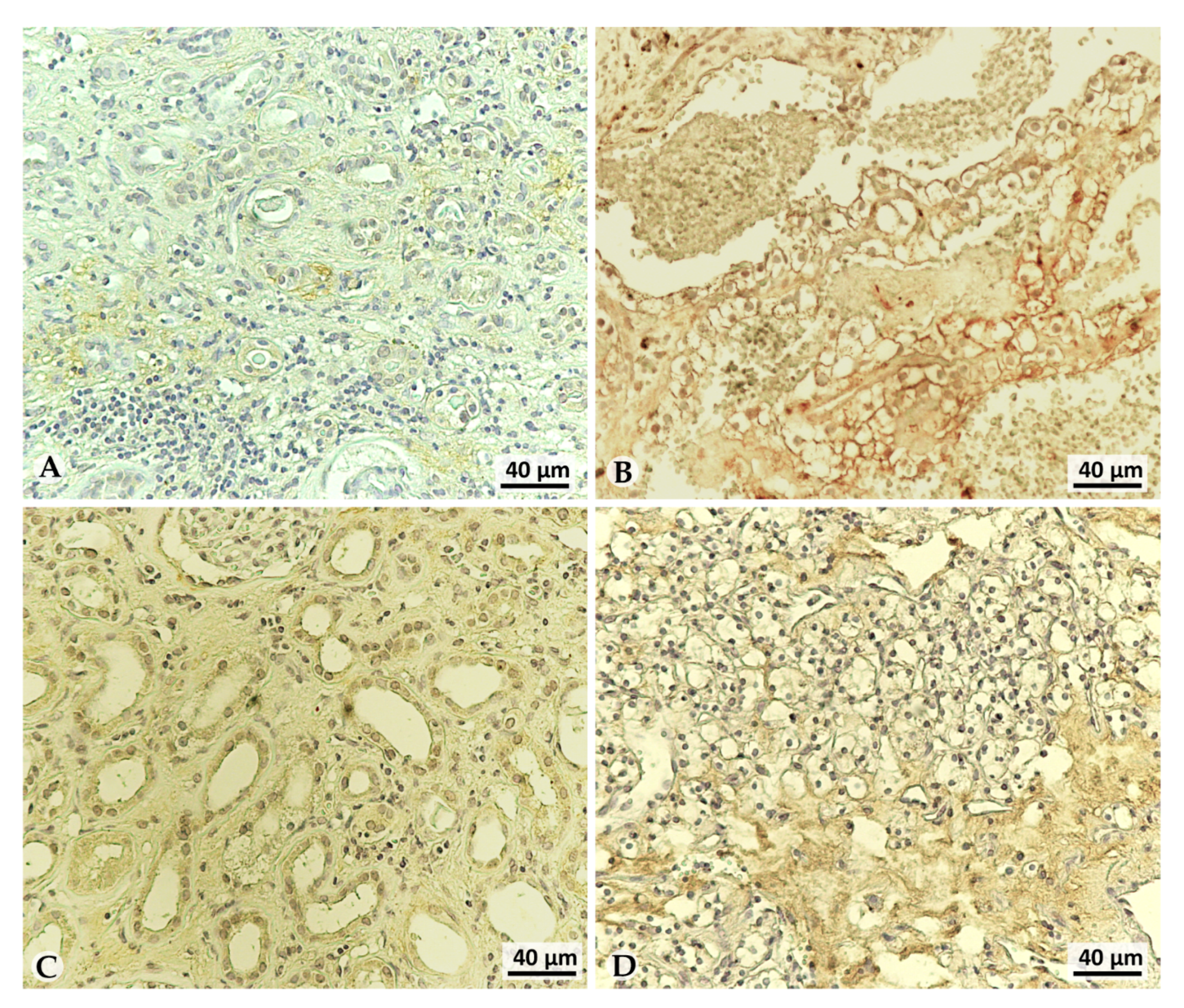 Cancers 13 04213 g004 Cancers 13 04213 g004