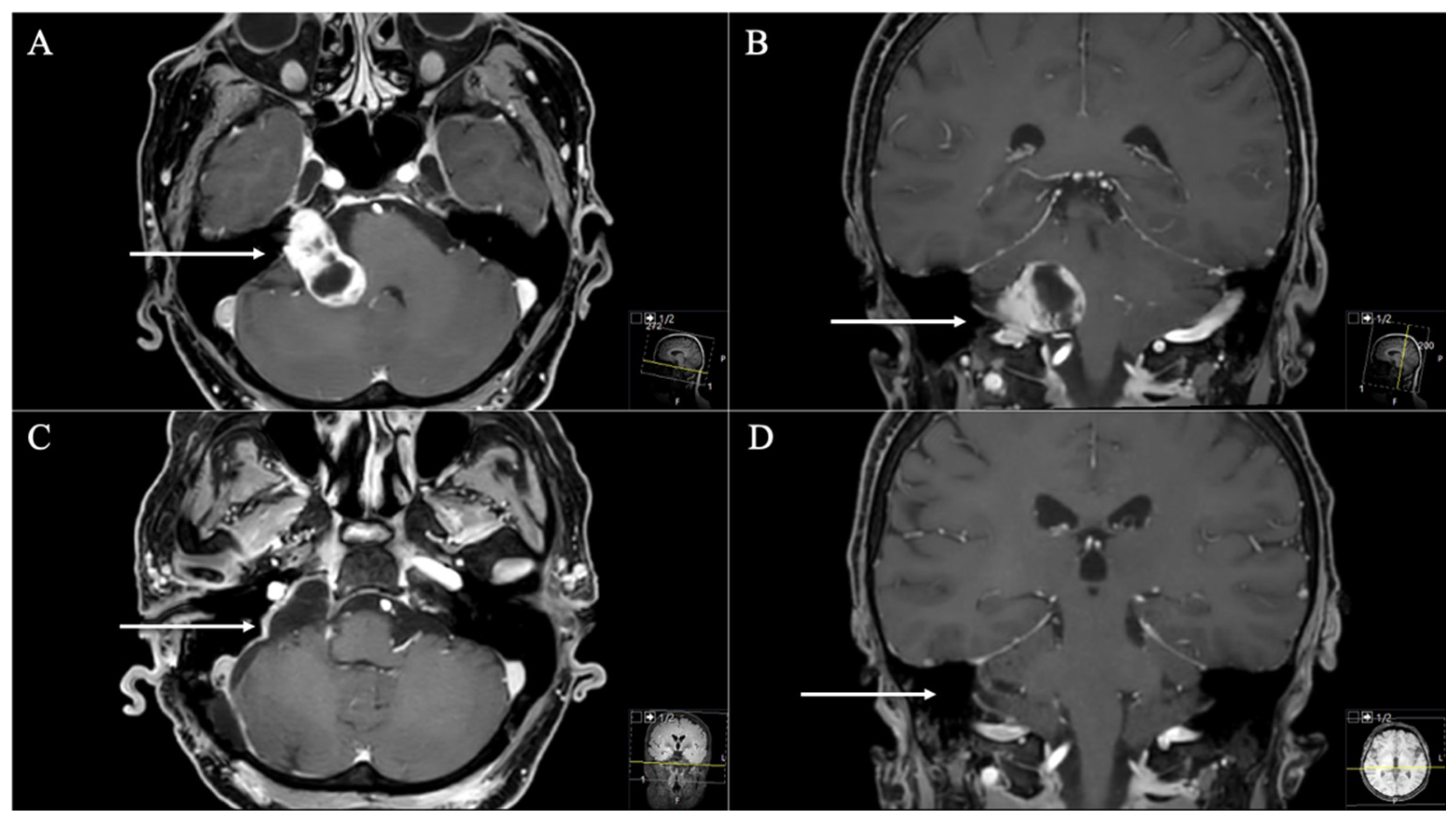 Cancers 13 04218 g001