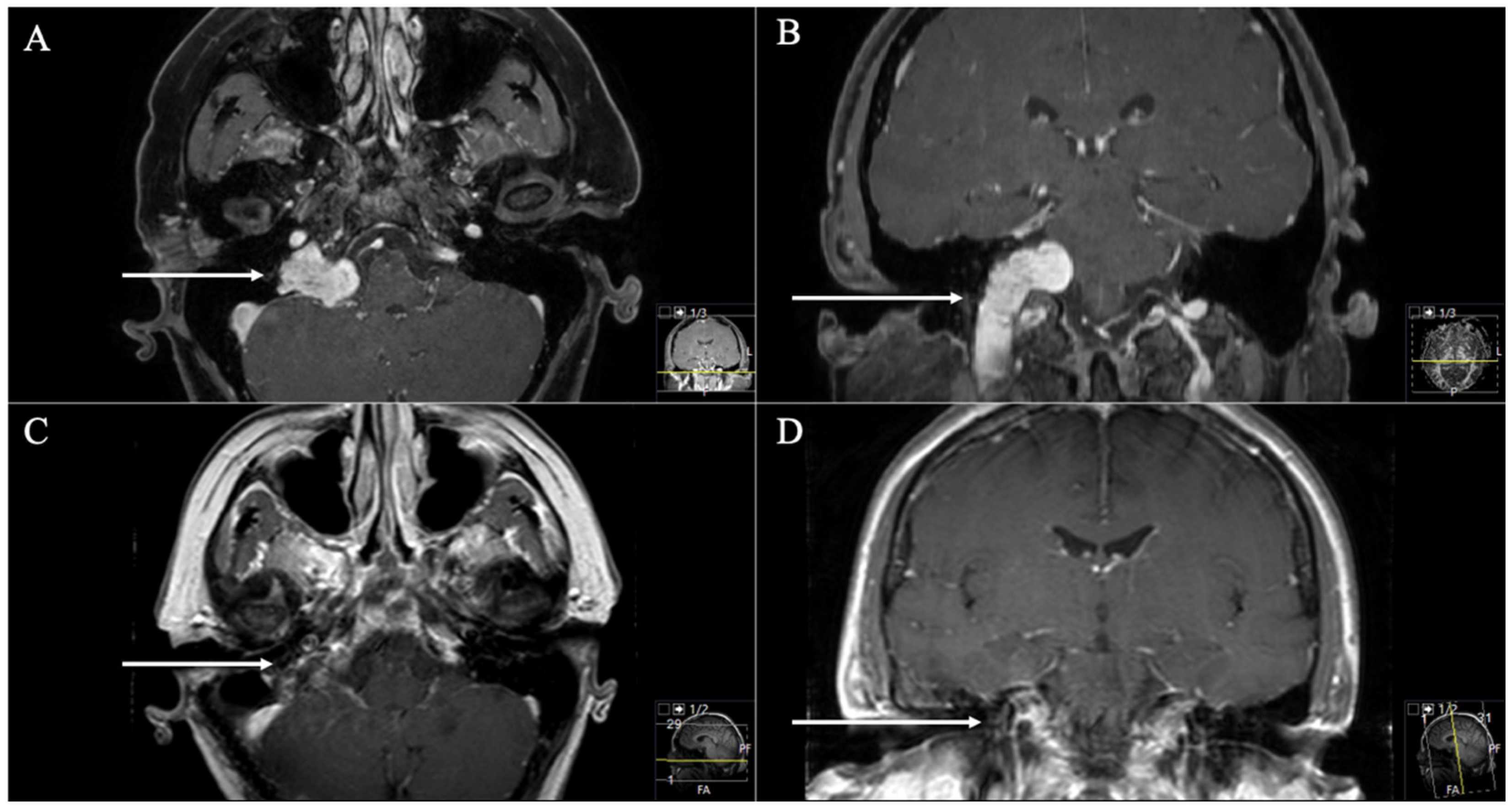 Cancers 13 04218 g003