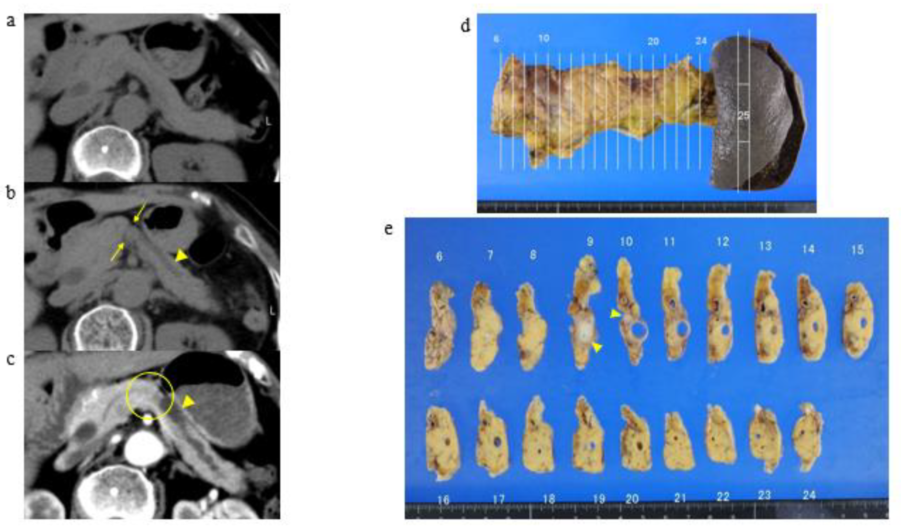 Cancers 13 04222 g003